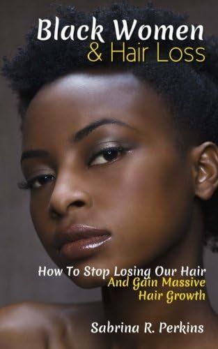 Black Women & Hair Loss: How To Stop Losing Our Hair & Gain Massive Hair Growth: 9781986975797: M... | Amazon (US)