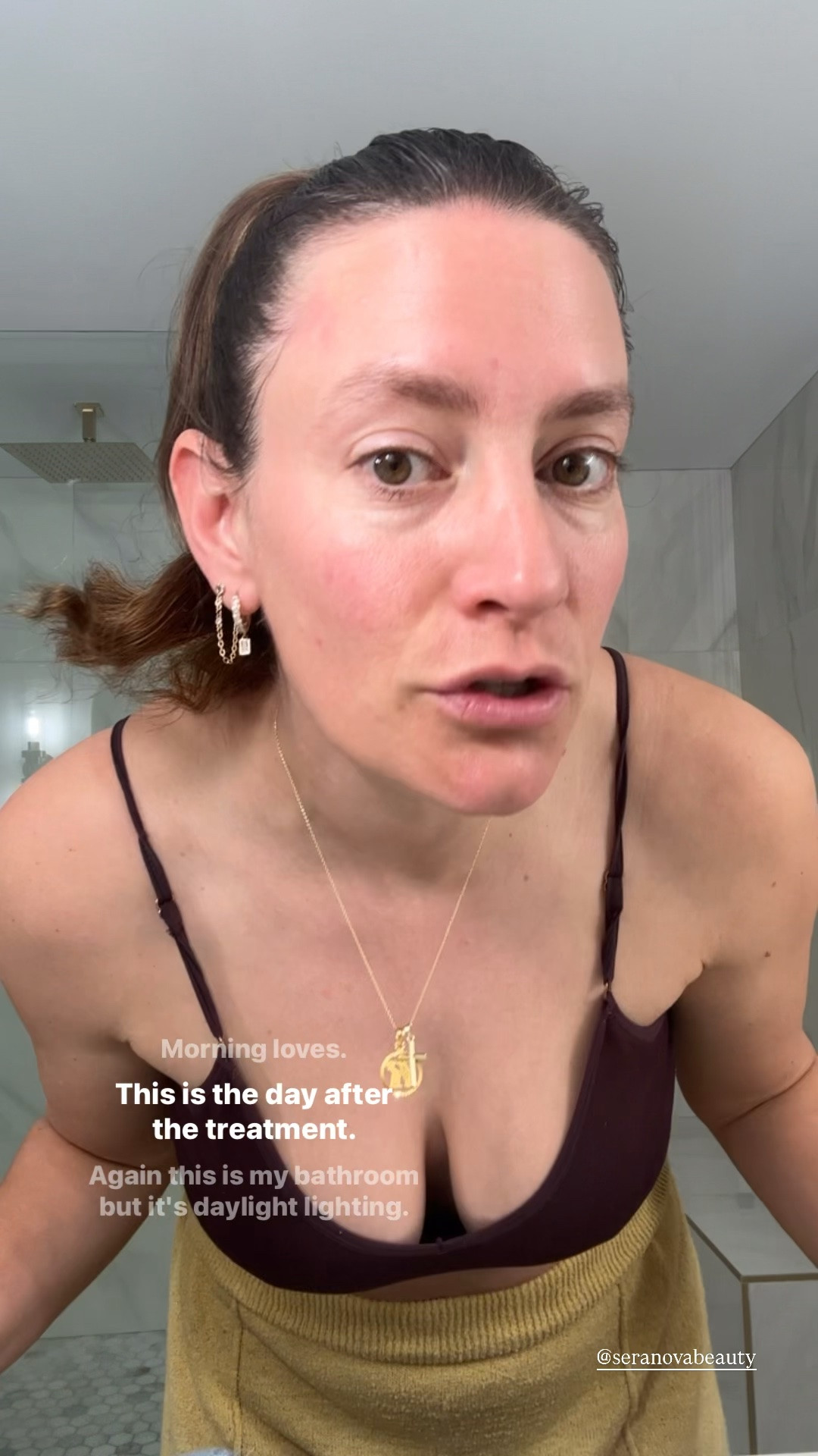 Seranova: The Next Day

#LTKselfcare