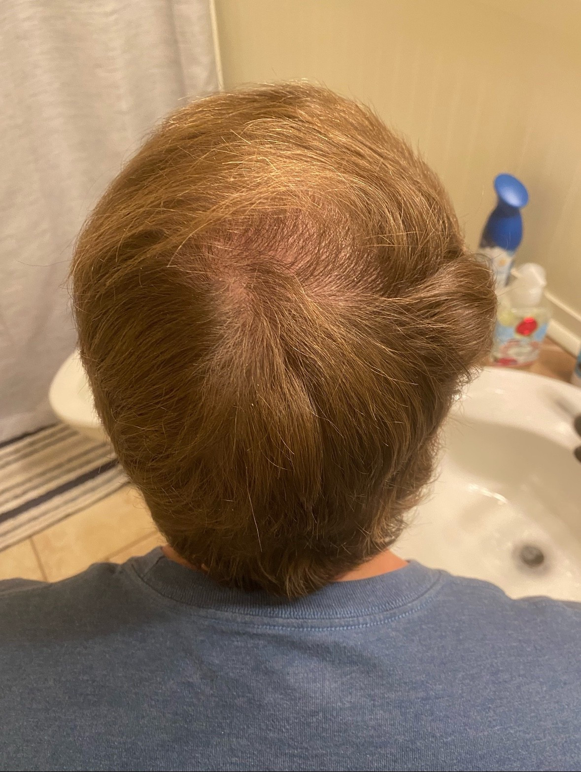 Hair loss favorites! 