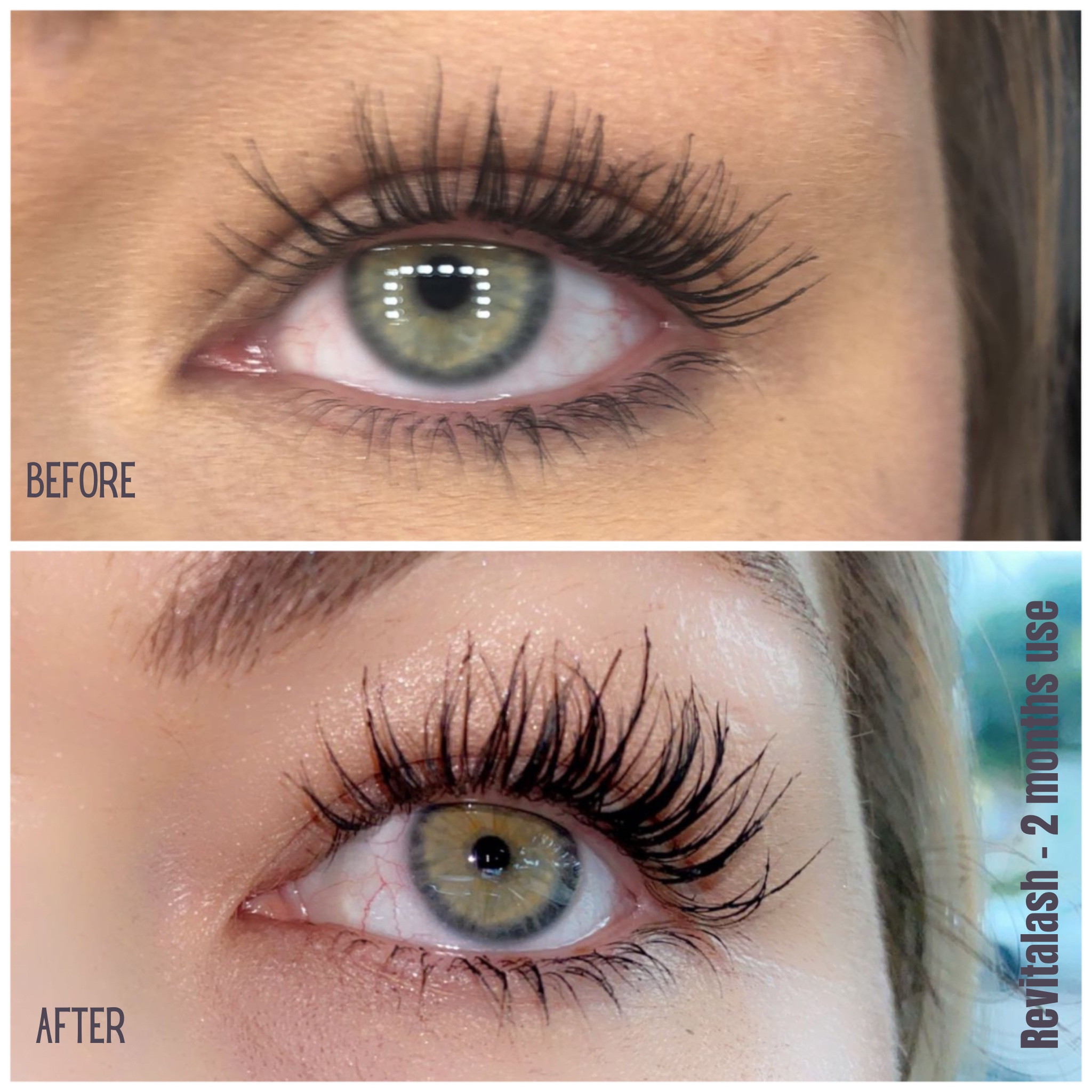 The BEST Eyelash Serum! I have tried many different serums, and this one has exceeded my expectations in so many ways. I’m currently on my 3rd bottle, and I don’t ever plan on stopping. A few main reasons why I love this product so much:
• The only ophthalmologist lash serum on the market.
•Helps condition and strengthen lashes while defending from breakage and brittleness.
•Causes no change in eye color like some other serums do.
•A portion of all proceeds benefit breast cancer and research alternatives.

For 15% off your first purchase, create an account and use the code CASSEY-R5. ❤️

I am very careful in products I choose and ingredients they contain. That is why I only choose to use safe, but effective products, and Revitalash eyelash serum is both of those things. :) The picture speaks for itself.

#LTKunder100 #LTKbeauty