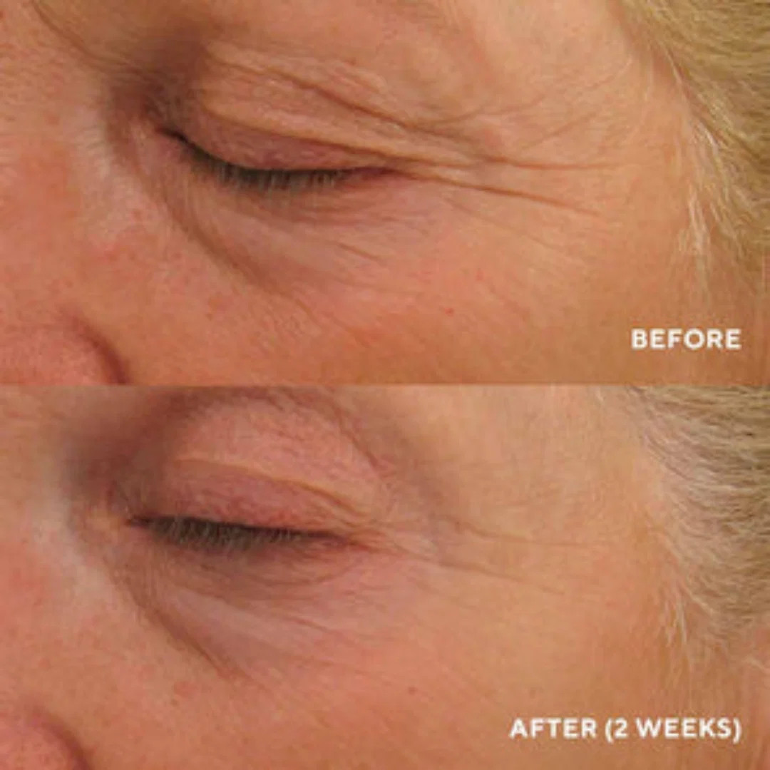 HydroPeptide Eye Authority | Face the Future
