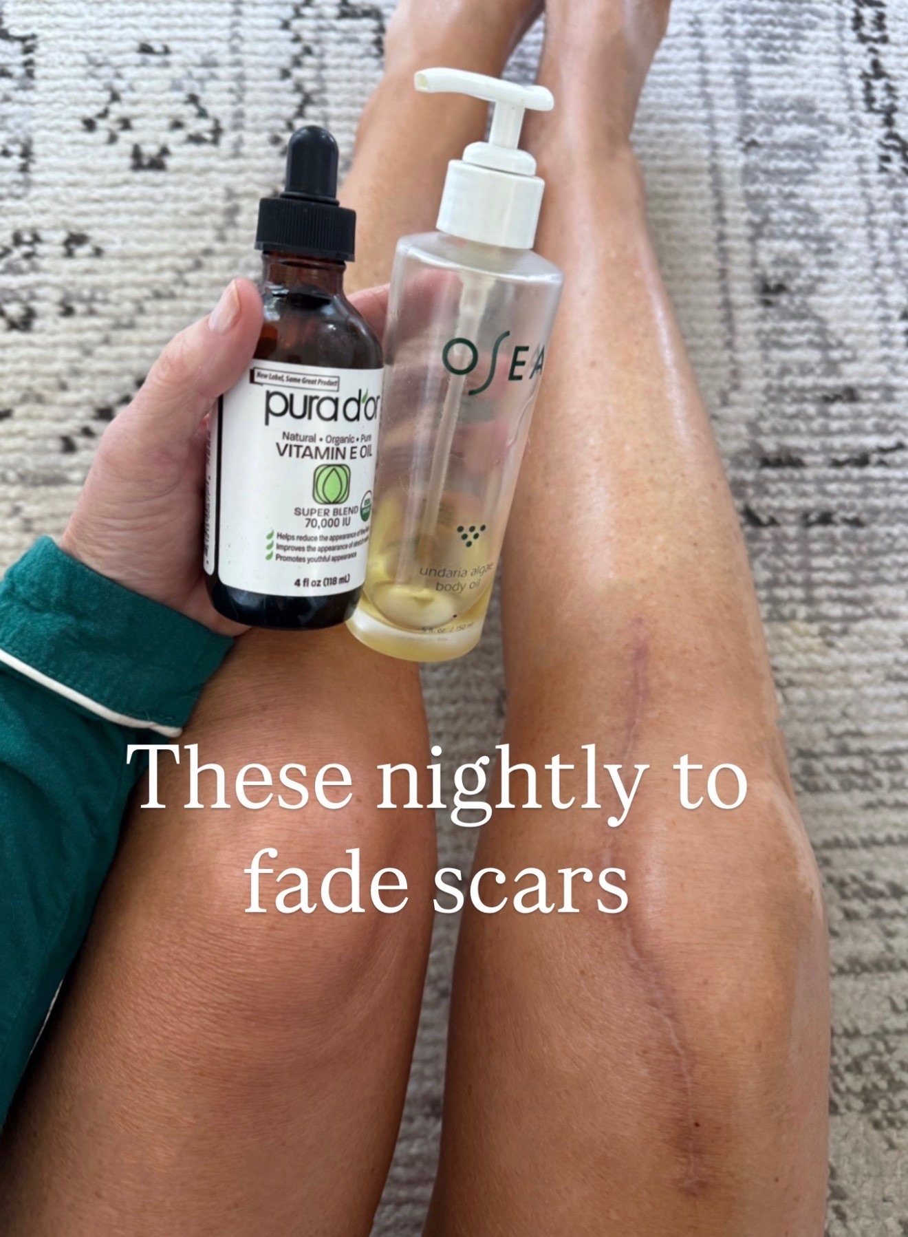 What I use to help with fading scars