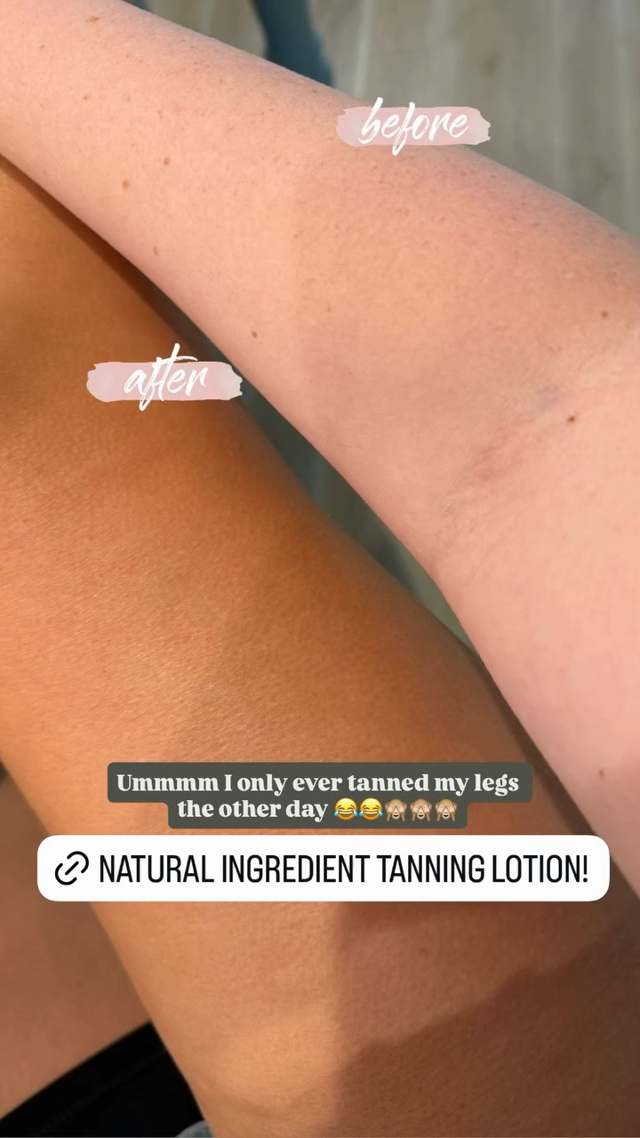 Ummmm I only ever tanned my legs the other day 😂😂🙈🙈🙈
Natural tanning lotion Amazon 

#LTKSeasonal #LTKmomlife #LTKselfcare