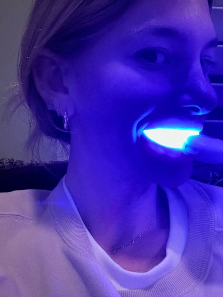 The best whitening kit actually ever it’s as insane as I look 

#LTKfindsunder50 #LTKfindsunder100