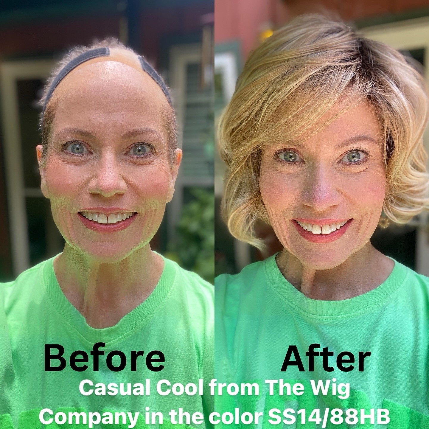 🌟✨ It’s Magic! ✨🌟

Wigs are absolute magic when you can go from a nearly bald head to such a beautiful head full of gorgeous blonde curls in the matter of a few seconds! I thank God for wigs every single day! 🙌🏻🙏🏻😍🤩❤️

This absolutely adorable new style is from @thewigcompany’s Fashion Club collection and it is called Casual Cool. 

This style is everything I ever dreamed of – it’s giving me major Meg Ryan from the 90’s vibes! 😍 I always wanted her iconic hairstyle, but thanks to wigs, I can finally have it. 🙌🏻👱🏻‍♀️❤️

This wig is so cute! Would you believe this is straight out of the box with only finger combing?! It’s also super lightweight, heat-friendly, and has the perfect amount of volume, with very little permatease. Plus, it comes in several amazing colors! This is the color SS14/88HB, a gorgeous dimensional rooted medium blonde. It has a basic cap, which is so much cooler in the summer! And best of all - this beautiful wig is only $69.90, and that’s without my discount code, so it’s very budget-friendly! 💰💵🤑

For a direct link to this wig, comment below with the word COOL and I’ll send it to your messages! The link will also be in my stories! 🌞🌻😎

A huge thank you to @thewigcompany for gifting me this fabulous wig in exchange for my content. If you’ve ever wanted to change up your look without the commitment, wigs are the way to go. And guess what? You can use my code **Cheryl30** to save 30% on your first purchase from The Wig Company!

Stay fabulous, friends! 💁‍♀️💖

#WigLife #WigLove #TheWigCompany #FashionClubCollection #90sVibes #MegRyanHair #WigInfluencer #Ad #Gifted

#LTKFindsUnder100 #LTKBeauty #LTKStyleTip
