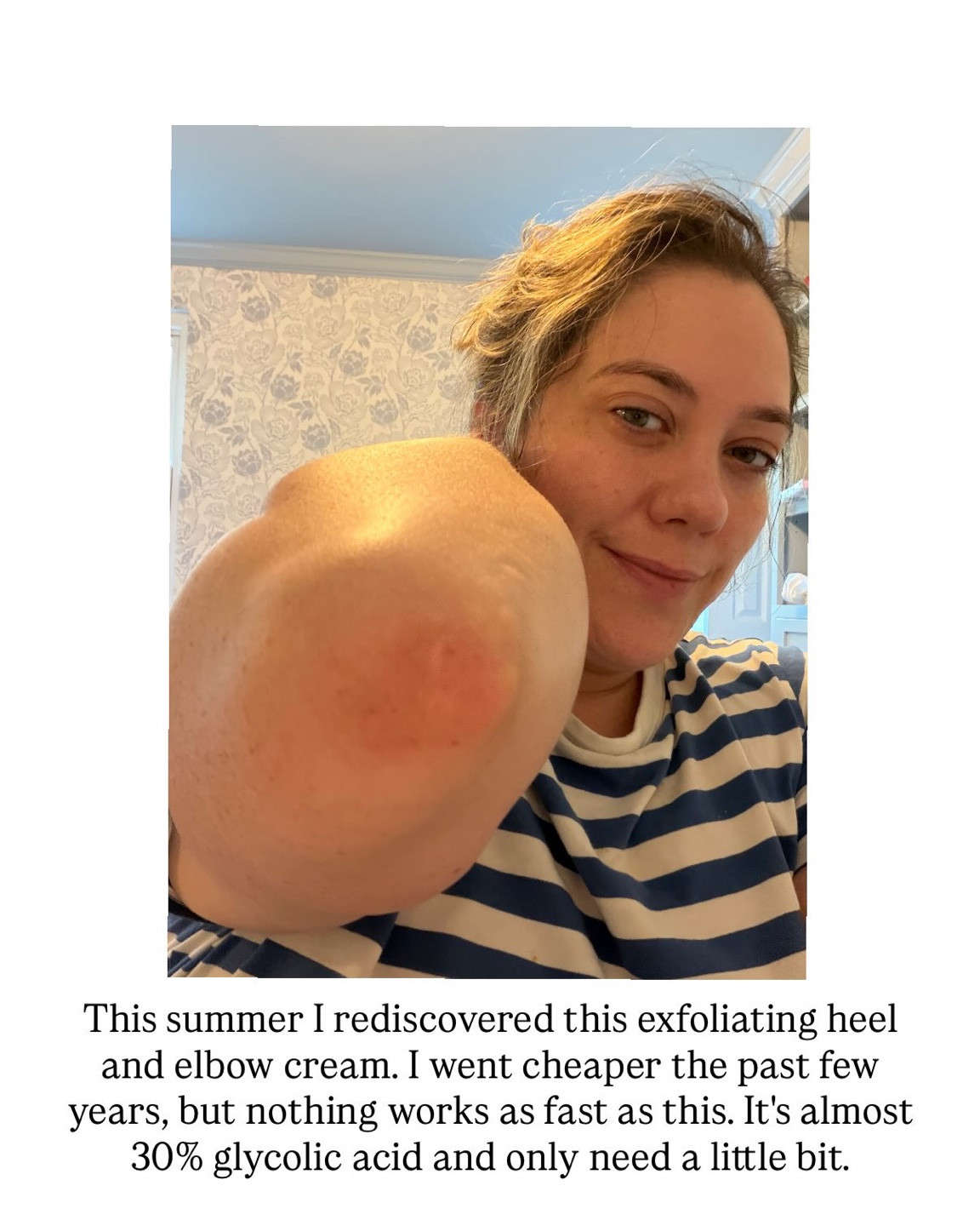 My dermatologist recommended this exfoliating heel and elbow cream, and truly nothing works better for me for dryness, peeling, and dark elbows. It’s almost 30% glycolic acid and literally revitalizes dry and crusty heels/elbows in one day. It’s pricier than other similar creams, but a small amount goes a long way, and it’s hands-down better than any other brand that I’ve tried.

#LTKBeauty #LTKselfcare