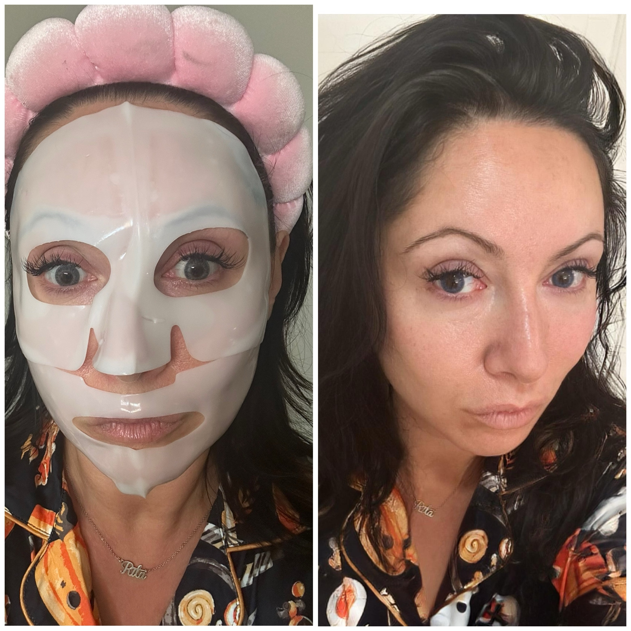 🌟 Achieve that coveted glass skin with our incredible overnight mask! 🌙✨ Experience amazing results as it works its magic while you sleep. Infused with collagen, this mask leaves your skin feeling rejuvenated and plump by morning. Wake up to a radiant glow that will have everyone asking for your secret! 💖 #GlassSkin #OvernightMask #CollagenInfusion #SkincareGoals

#LTKBeauty #LTKFindsUnder50