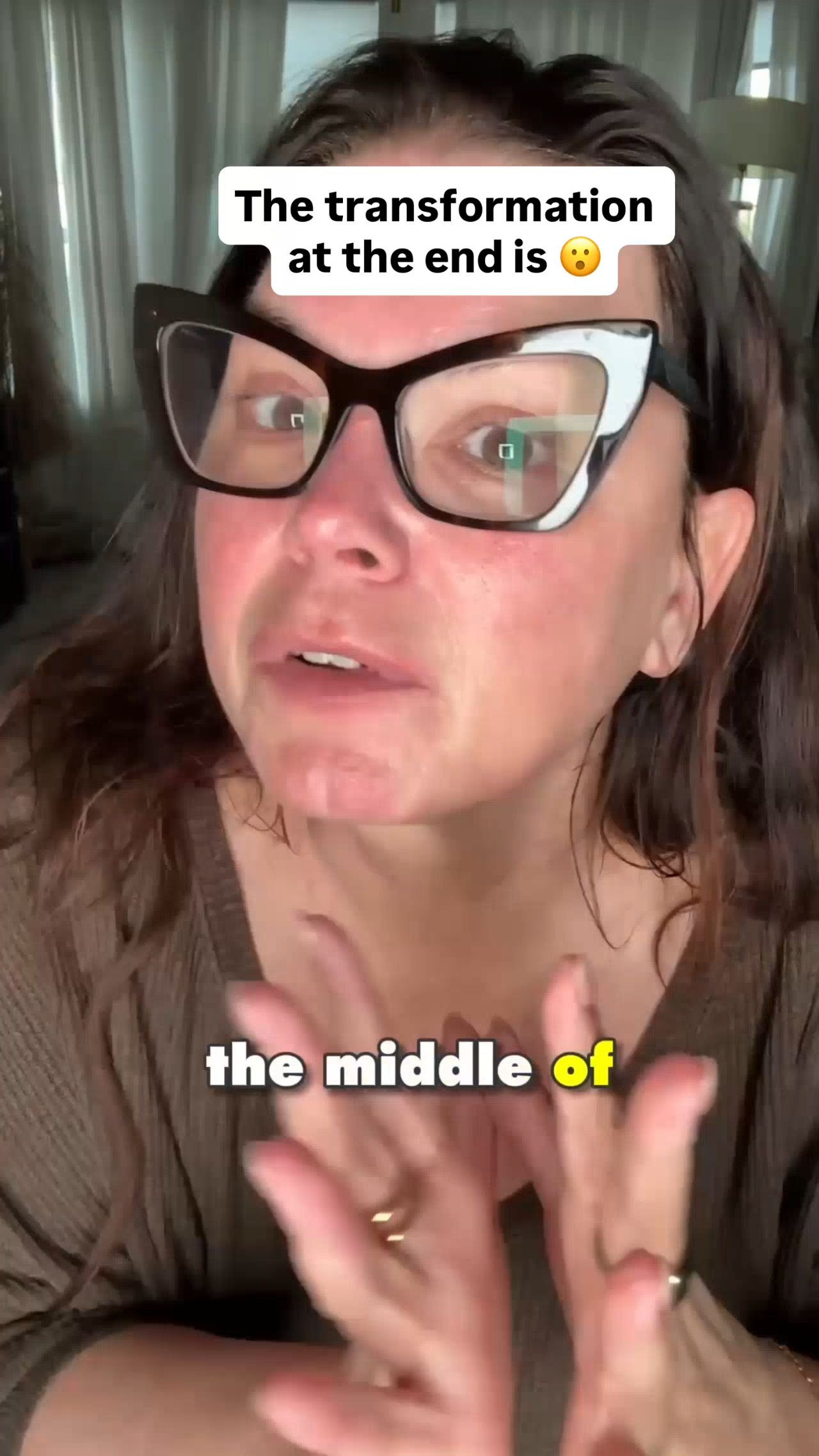 Your rosacea isn't flaring because you're doing something wrong. It's flaring because your barrier can't hold itself together anymore.
Here's what most people do during a flare: strip back to "gentle" products, slap on a cream, and wait. But if the barrier is already compromised—and with rosacea, it almost always is—a single moisturizer can't repair what's broken. Your skin needs hydration, lipid nourishment, AND occlusion. In that order.
That's why I built the Barrier Repair Kit. Three products, three layers, working the way a healthy barrier actually functions:
→ Water Elixir floods your skin with lightweight hydration so compromised cells can actually absorb what comes next
→ Water Oil delivers the lipids your barrier has stopped producing on its own—without overwhelming reactive skin
→ Intense Barrier Cream seals everything in with ceramide NG, a triple-occlusive system, and calming ingredients like niacinamide and licorice root
No fragrance. No actives. No complications. Just what a flaring barrier actually needs.
After 35 years and thousands of faces—including my own rosacea—I know that calming a flare isn't about one product. It's about giving your skin the system it's missing.
Kit ships free. Link below. 

 #LTKselfcare #LTKstorytime #LTKBeauty