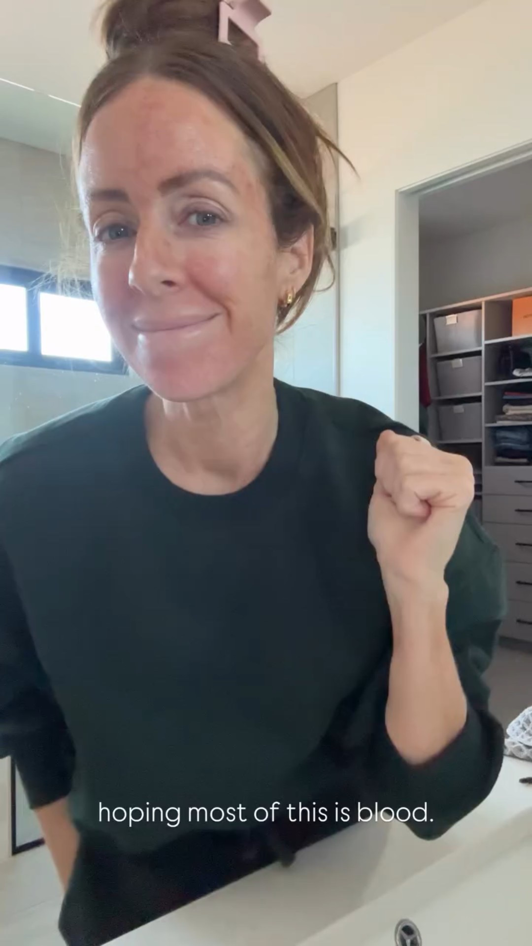 hoping most of this is blood.