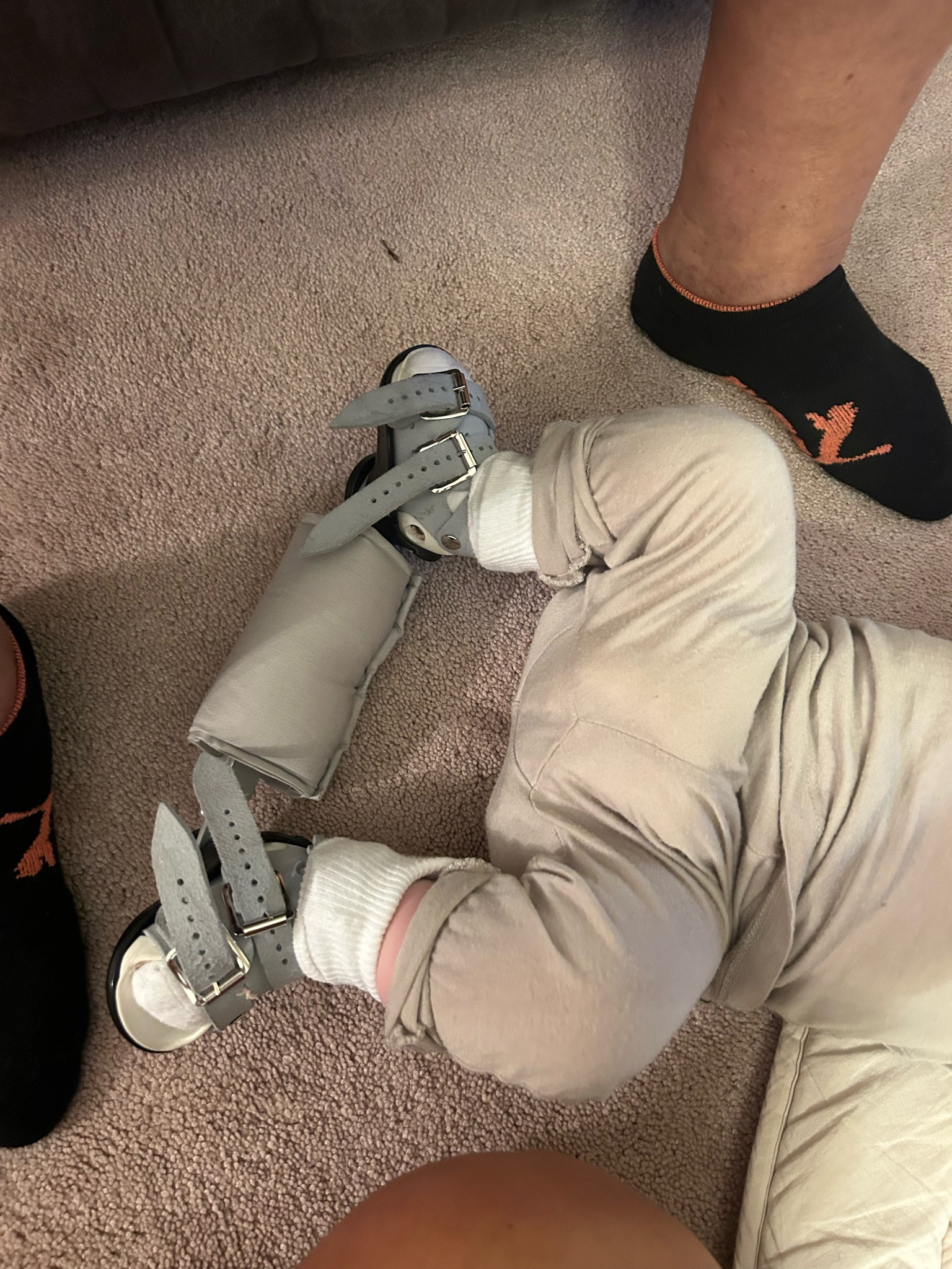 Club foot boots cover 

#LTKKids #LTKBaby #LTKFamily