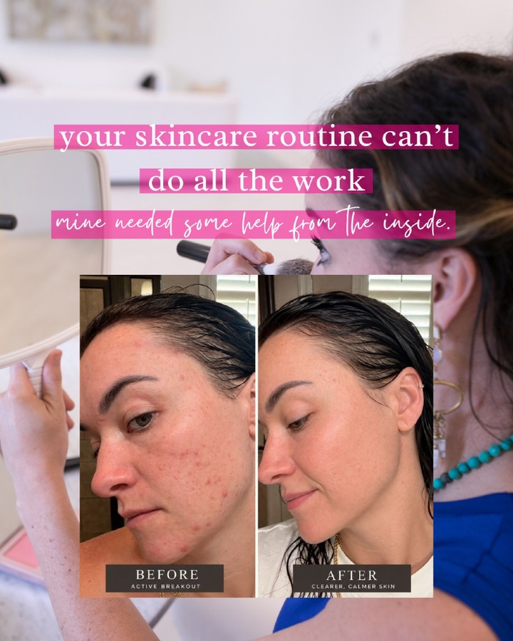 Comment BEAUTY & I'll send you the link that launched officially TODAY and has a high sell out risk! 🚨

I’m sorry... WHAT?! 😳 Swipe to see the skin results that have me absolutely SHOOK.

At 40, I’m not trying to look 25. I want to age WELL. But I also want clearer, healthier-looking skin, fewer breakouts, and to actually feel GOOD when I look in the mirror.

And y’all... my own before + afters are why I cannot stop talking about this. I’ve been testing MAKE’s new Beauty pept!de + skincare before launch, and seeing the difference in MY skin made me pay attention FAST. 👀

This is what I love about the pep conversation: it’s not just about adding another anti-aging cream to an already crowded bathroom counter. I’m interested in supporting healthy-looking skin from the inside out AND having a simple topical routine that supports it from the outside.

And today is DAY ONE. 🔥 If you’ve been watching my skin journey—or you just looked at those before + afters and thought OKAY I NEED DETAILS—this is your sign to look now because I would not be surprised if this sells out.

Comment BEAUTY and I’ll send you exactly what I’ve been using + the launch details. 💕

Because the proof for me is literally on my face.😳

#SundayReset #HealthyByHeatherBrown Mind Body Spirit Health | Biblical Health | Millennial Mom