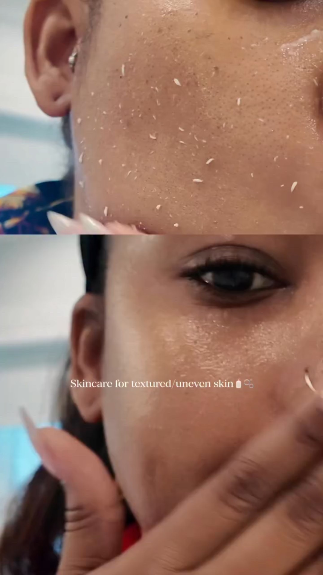 Highly requested… My current skincare routine | Combination + Textured skin 🧴🫧🧼

I use these five products because they work together perfectly for my combination, textured skin…gentle cleansing without stripping, chemical exfoliation to smooth bumps, and actives to refine texture long-term while keeping things balanced and hydrated.

🫧Naturium Multi-Calm Cream Cleanser → My go-to gentle, creamy cleanser that removes impurities and makeup without drying out my cheeks or irritating sensitive areas..it soothes and helps maintain my skin barrier.

-🫧 Dr.Jart+ Ceramidin Brightening Peeling Gel → This mild physical + chemical exfoliator gently buffs away dead skin and roughness for a brighter, smoother surface without being too harsh on combo skin.

🫧 Proactiv Re-Texturizing Toner → My daily exfoliating toner with salicylic acid+ glycolic acid that clears pores, smooths texture, and prevents breakouts in my oily zones while refining overall unevenness.

-🫧Naturium Multi-Peptide Advanced Serum → A lightweight peptide powerhouse that improves texture, firms, hydrates, and plumps…it helps my skin look smoother and more even without feeling heavy.

-🫧 Eight Saints Smooth Sailing Retinol Moisturizer → My nighttime retinol treatment that speeds up cell turnover to fade bumps, minimize pores, and even out texture over time …it’s nourishing enough for combination skin and helps everything else work better. I switch this out in the day time with the whip cream! 

This combo keeps my skin exfoliated, smooth, and calm without overdoing it! ✨ 

#beauty #texturedskin #skincare2026 #dmvinfluencer #nycinfluencer