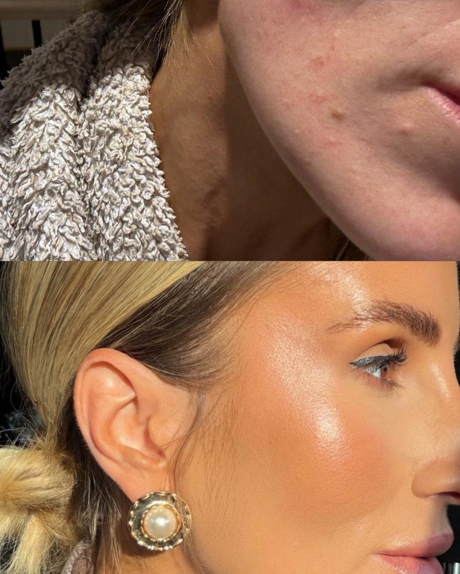 Congested skin must haves!!

#LTKstyletip #LTKbeauty #LTKuk