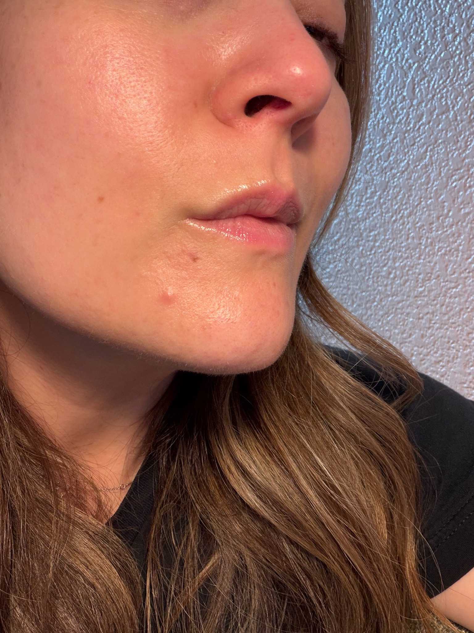 Perimenopause skincare could mean a whole new routine because what was working now irritates. 

Here is what I’m using right now as a 43 year old with dry skin, fitz 2, suddenly breaking out.

#LTKdayinmylife #LTKmorningroutine #LTKOver40