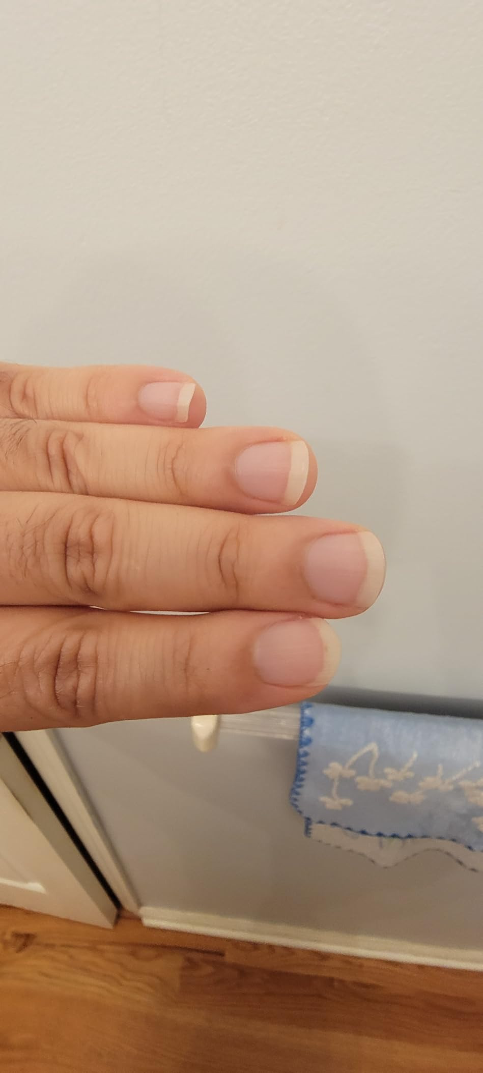 Sports Research® Bovine Colostrum Powder – Easy to Mix, Single Ingredient Superfood – Immuni... | Amazon (US)