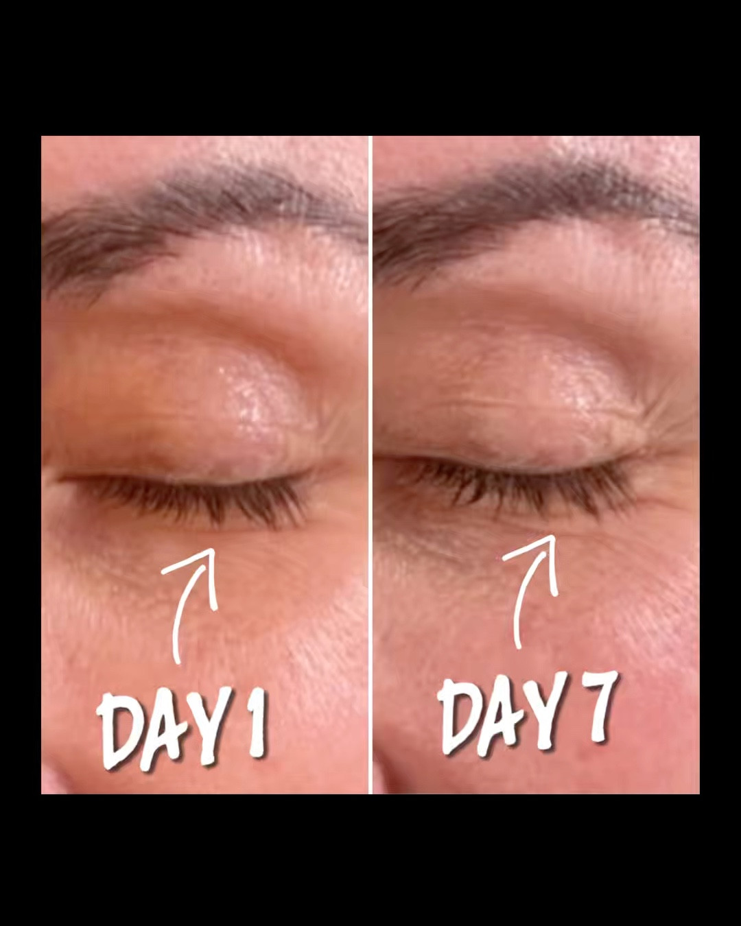 After just one week of consistent use, I am in AWE! My lashes look noticeably healthier, fuller, and more defined. 

What truly sets Eight Saints Batting Season Eyelash Serum apart is how it nourishes the lash roots. It’s amino acid rich formula strengthens and protects your lashes, improving lash health and reducing everyday breakage from makeup removal and cleansing. A natural eyelash serum that you can really see how the biotin and peptides support growth, and the Hyaluronic Acid keeps them soft and hydrated. My lashes appear healthier and glossy from the base up. 

Just look how much thicker and longer my lashes look after just 1 week of applying the serum at night! The proof is in the results! And I love that it is not sticky and is super lightweight. 

Eight Saints natural eyelash serum is a gentle and effective option for anyone looking to support lash health, especially if your lashes are thinning, fragile, or stressed.

And who doesn’t want healthy, natural fluttery eyelashes?! 

#LTKBeauty #LTKOver40 #LTKstorytime
