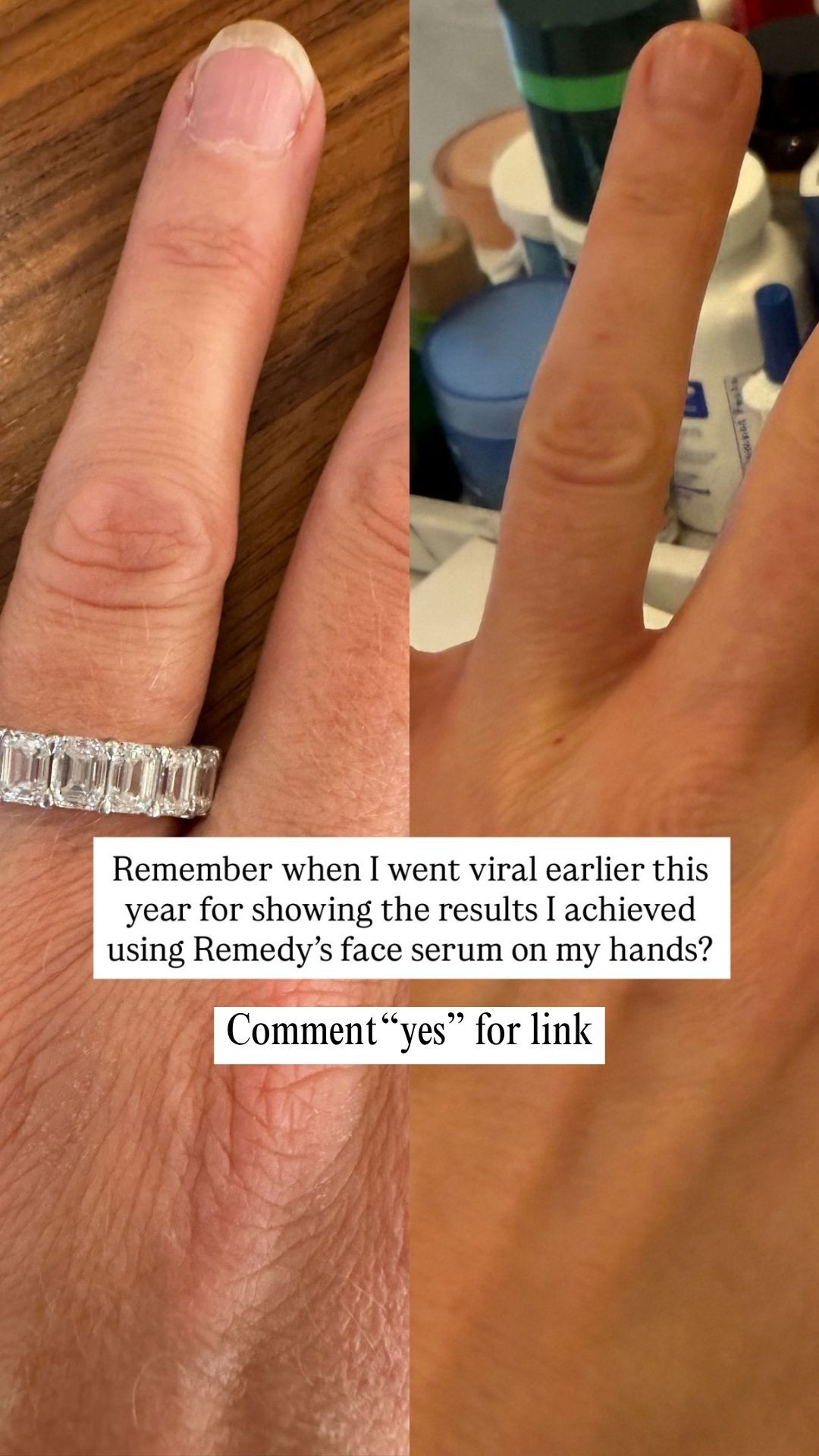 Remember when I shared the results I got from using this on my hands? 👀 This is one of those products that really made me want to keep using it. I love having it in my routine, especially when my skin needs a little extra attention. 

 #LTKselfcare #LTKBeauty