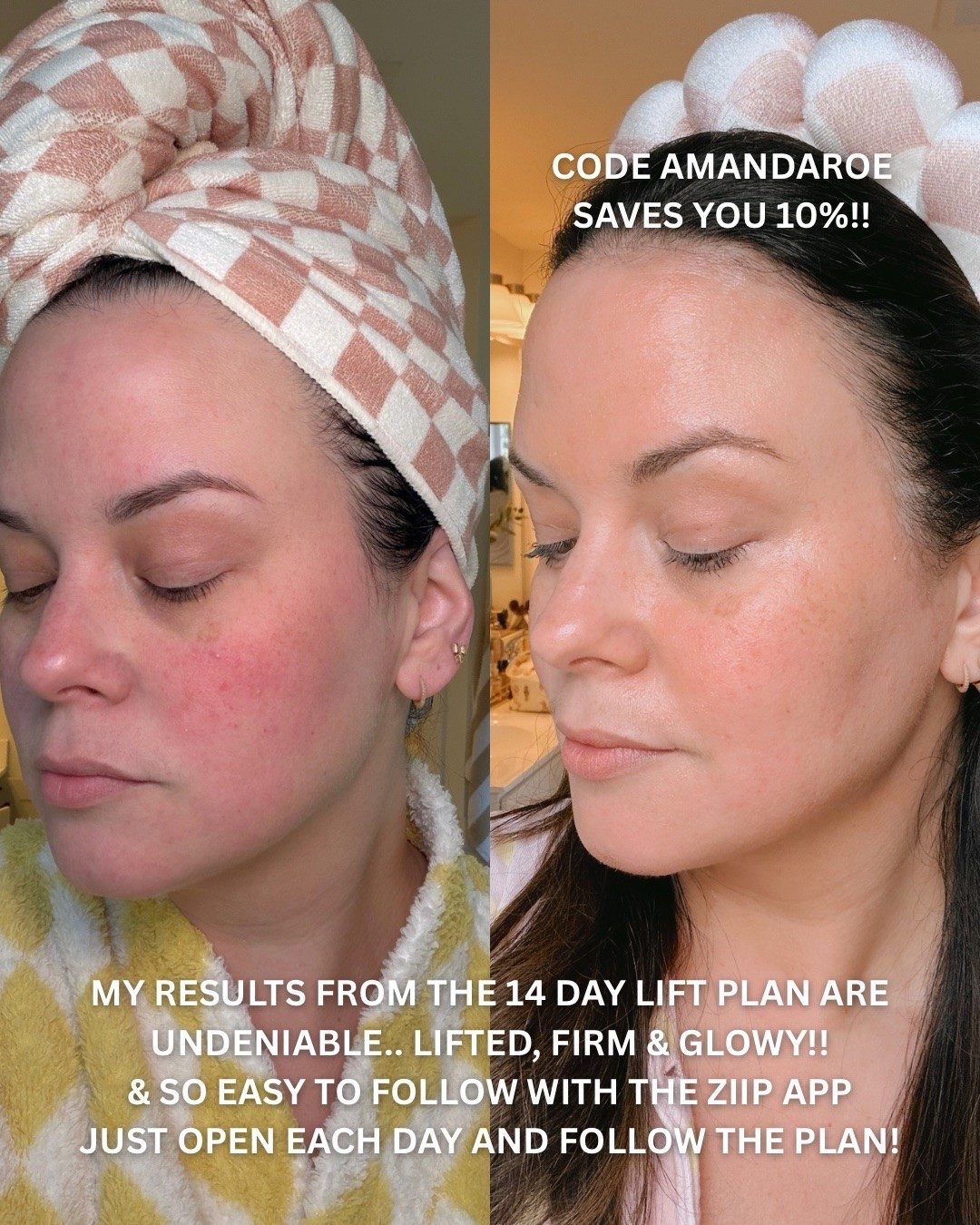 Obsessed with my ZIIP Halo device!!

#LTKOver40 #LTKselfcare #LTKBeauty