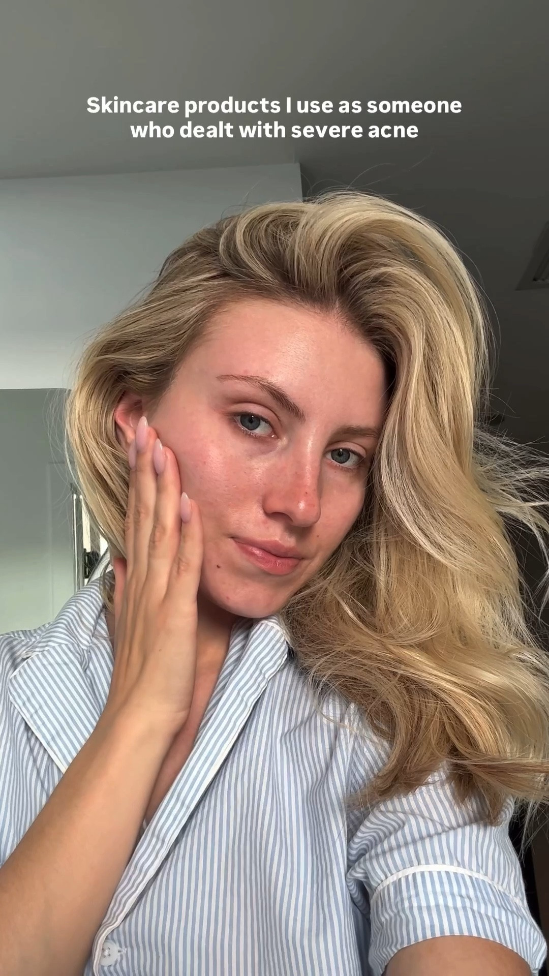 I’ve been using CLEARSTEM Skincare for over three years on my skin and it has truly changed my life!!! It’s so nice having the peace of mind knowing that every single product they have is acne safe!

#LTKmorningroutine #LTKselfcare #LTKBeauty