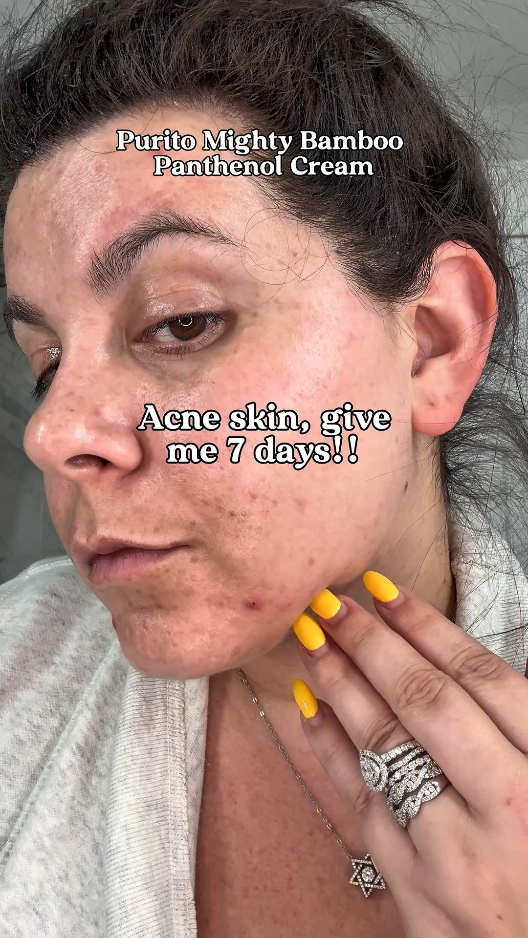 Purito Mighty Bamboo Panthenol Cream has been helping my acne prone skin so much

#LTKBeauty #LTKFallSale #LTKFindsUnder50