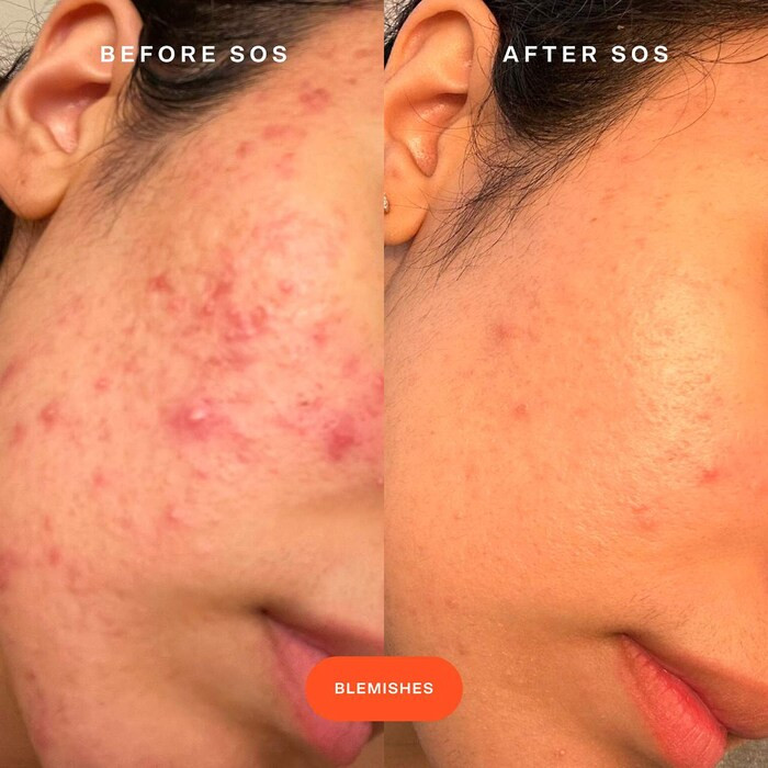 Mini SOS Save.Our.Skin Daily Rescue Facial Spray - Tower 28 Beauty | Sephora | Sephora (US)