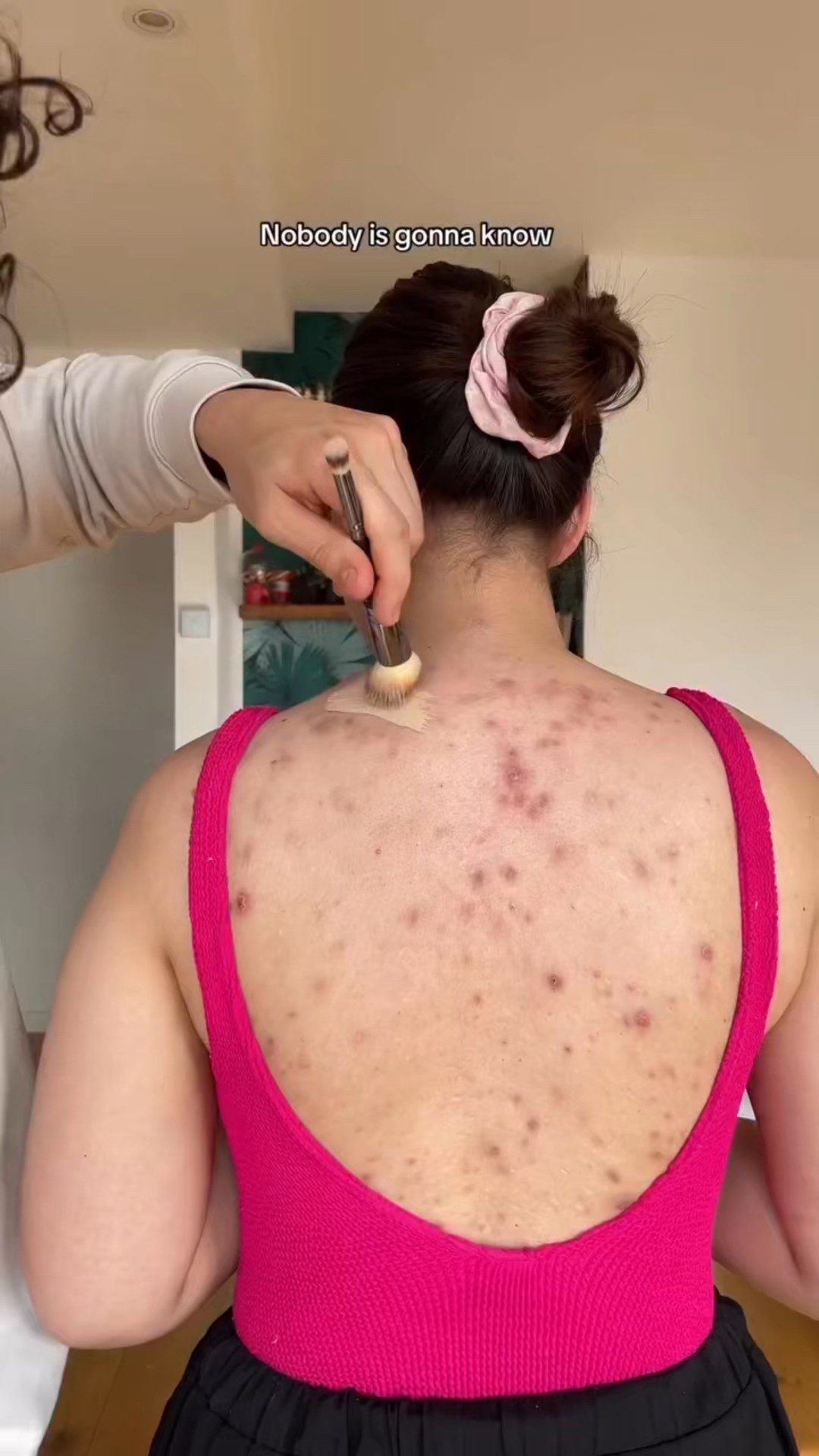 Clear your back acne with these holistic non toxic tips.

#LTKU #LTKBeauty #LTKSeasonal