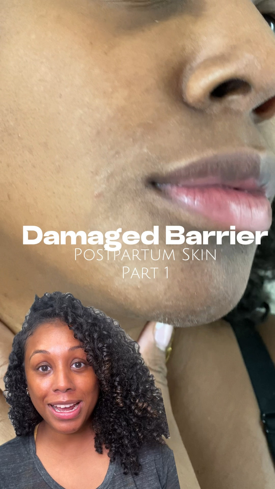 5 easy tips on how to reverse a damaged barrier. Postpartum skin tips 

#LTKSeasonal #LTKBump #LTKBeauty