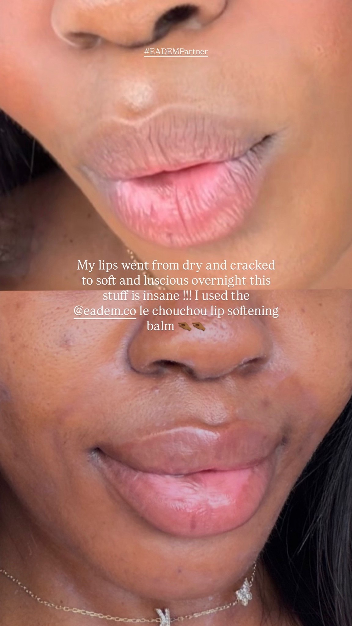 finally unlocked the secret to soft, kissable lips🫦🔓#EADEMPartner
@EADEM le chouchou lip softening balm is the key to getting rid of dry, peeling lips overnight! available at @sephora #drylips #lipcare #lipcareroutine #eadem