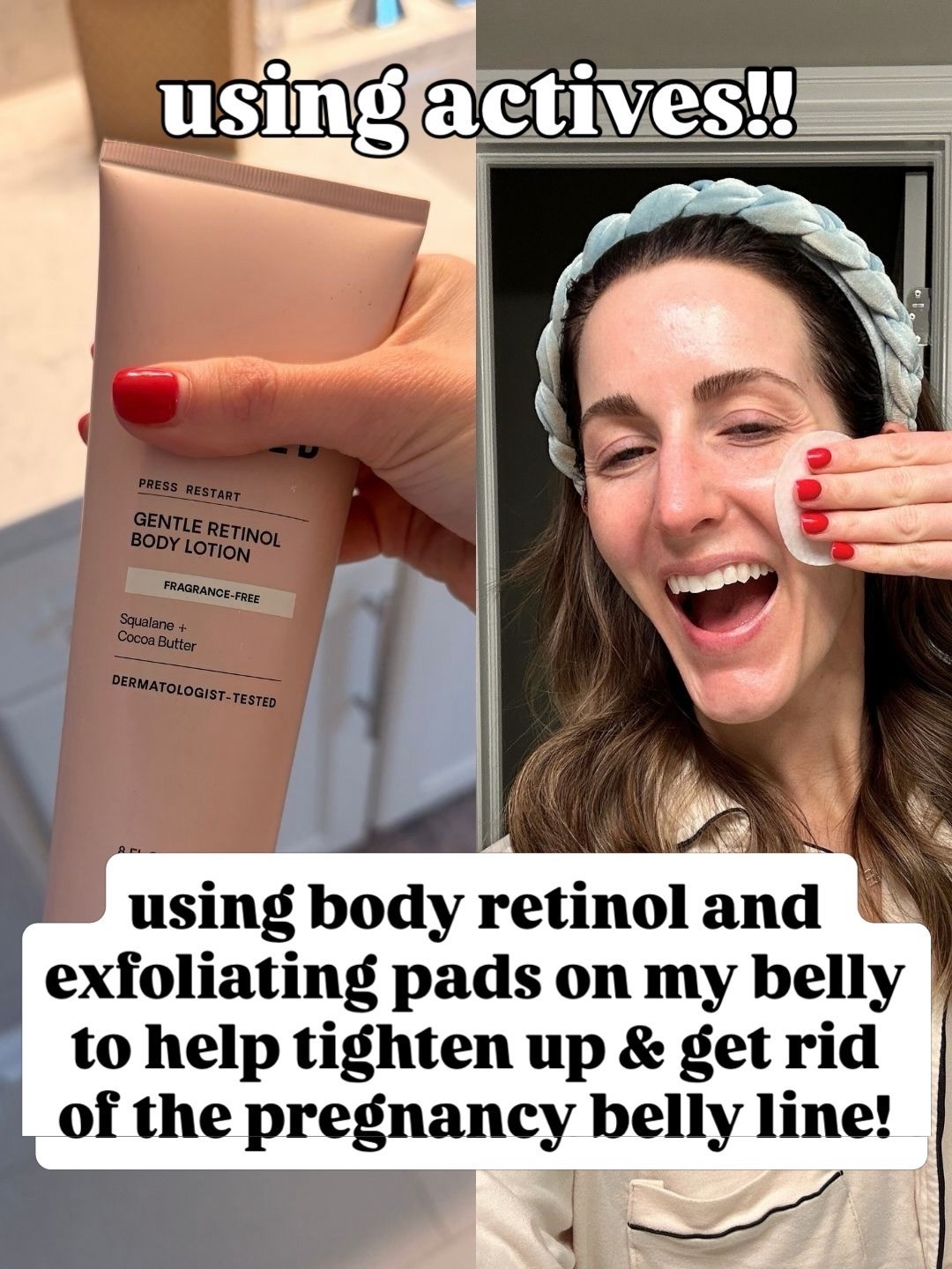 These save my skin!