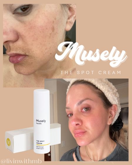 My absolute #1 skincare product is The Spot Cream by Musely.

This CHANGED. MY. SKIN  

#LTKfindsunder100 #LTKover40 #LTKbeauty