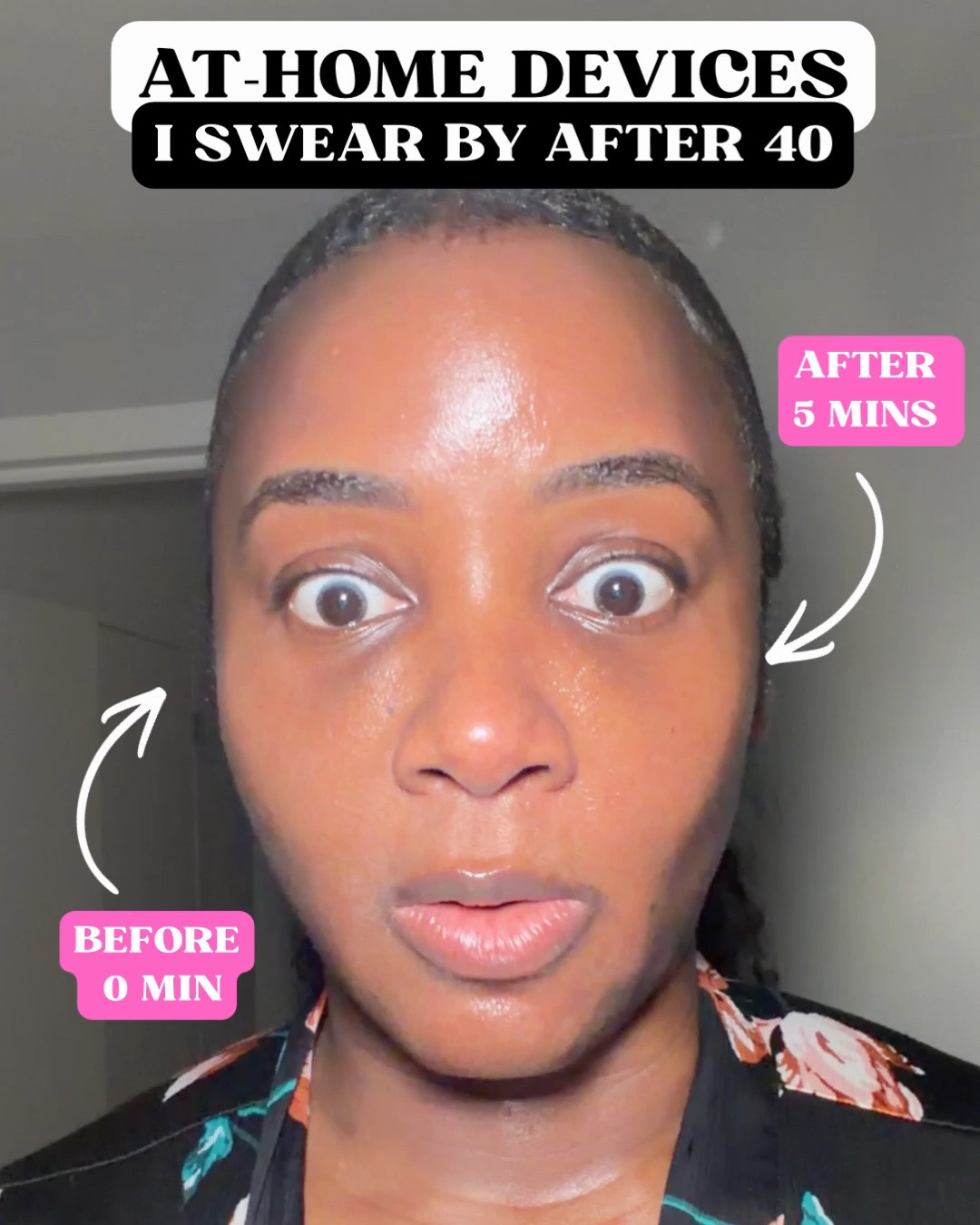 At-home devices I love for my over 40 skin

#LTKOver40 #LTKBeauty #LTKselfcare