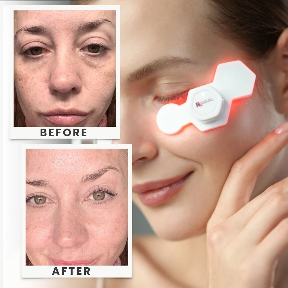 PlasmaGLO LED DUO -- UNDEREYE CORRECTOR | Rajani MD