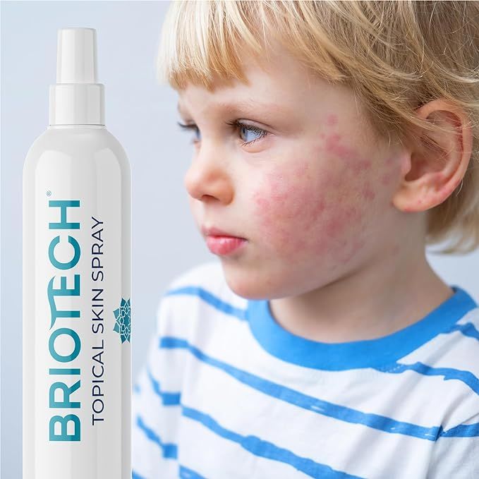 BRIOTECH Pure Hypochlorous Acid Spray, Multi Purpose Topical Body & Facial Mist, Eyelid Cleanser,... | Amazon (US)