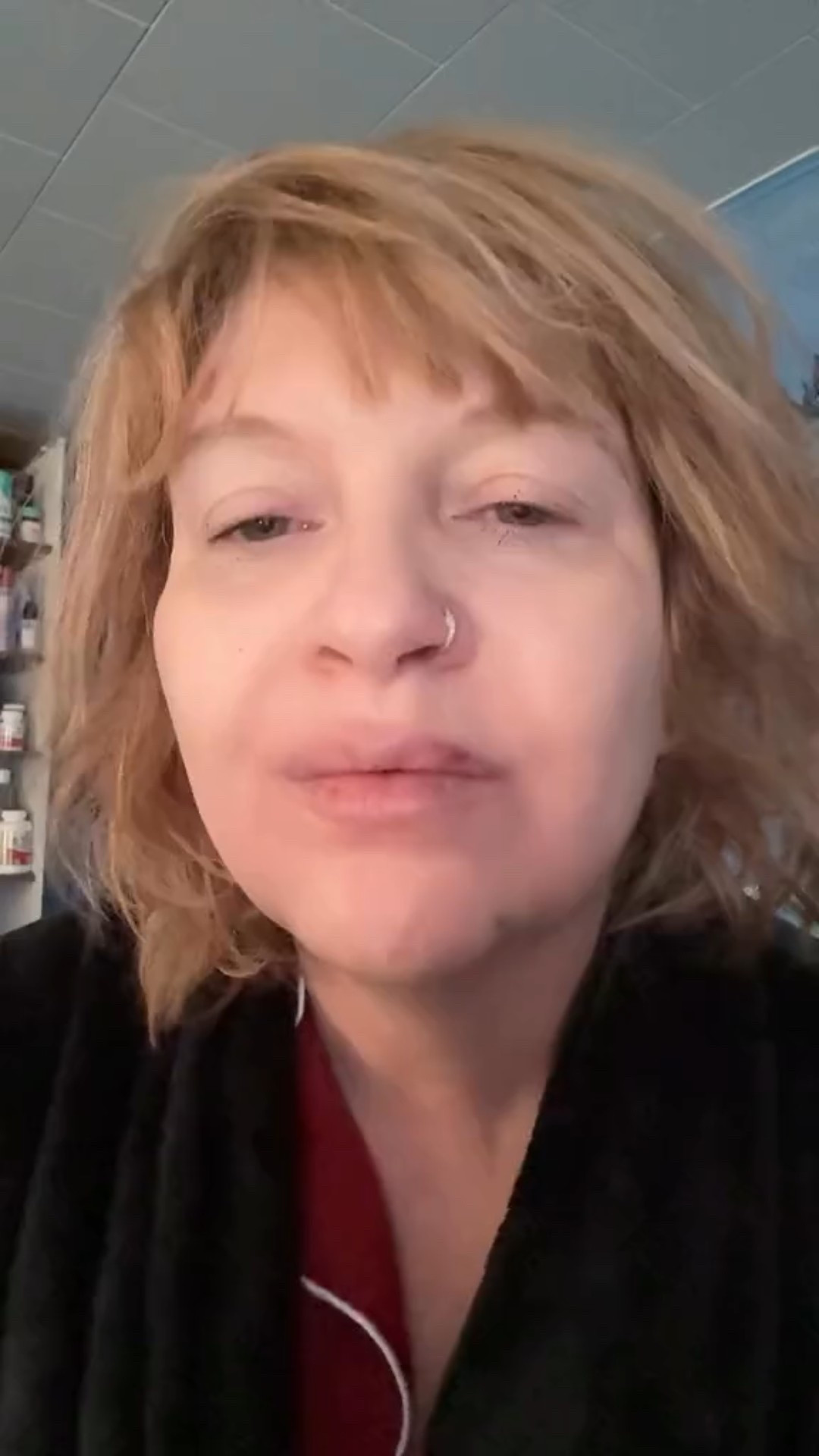 24 hours After Dermal Filler: A little bruising, a little swelling, but looks great!

@emberaesthetics_ @injector.karinn 

#fightingmothernature #emberaesthetics #dermalfillerlips #dermalfıllers #over50beauty