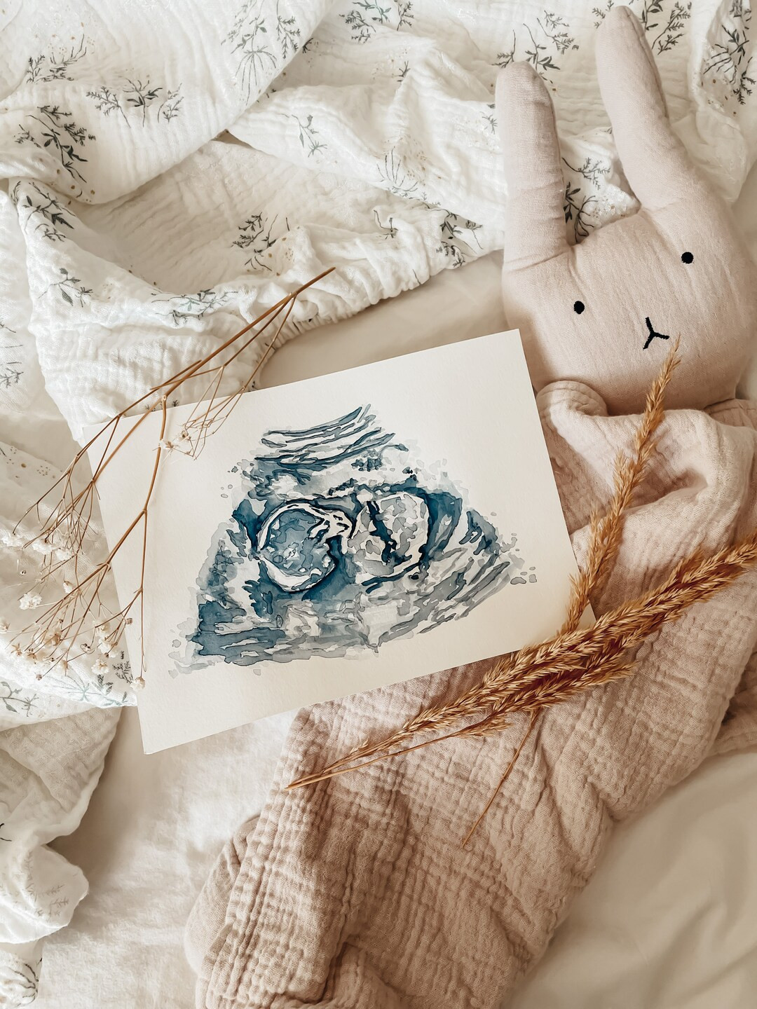 Heirloom Ultrasound or Sonogram Watercolor Painting | Baby Ultrasound Art, Nursery Decor, Ultraso... | Etsy (US)