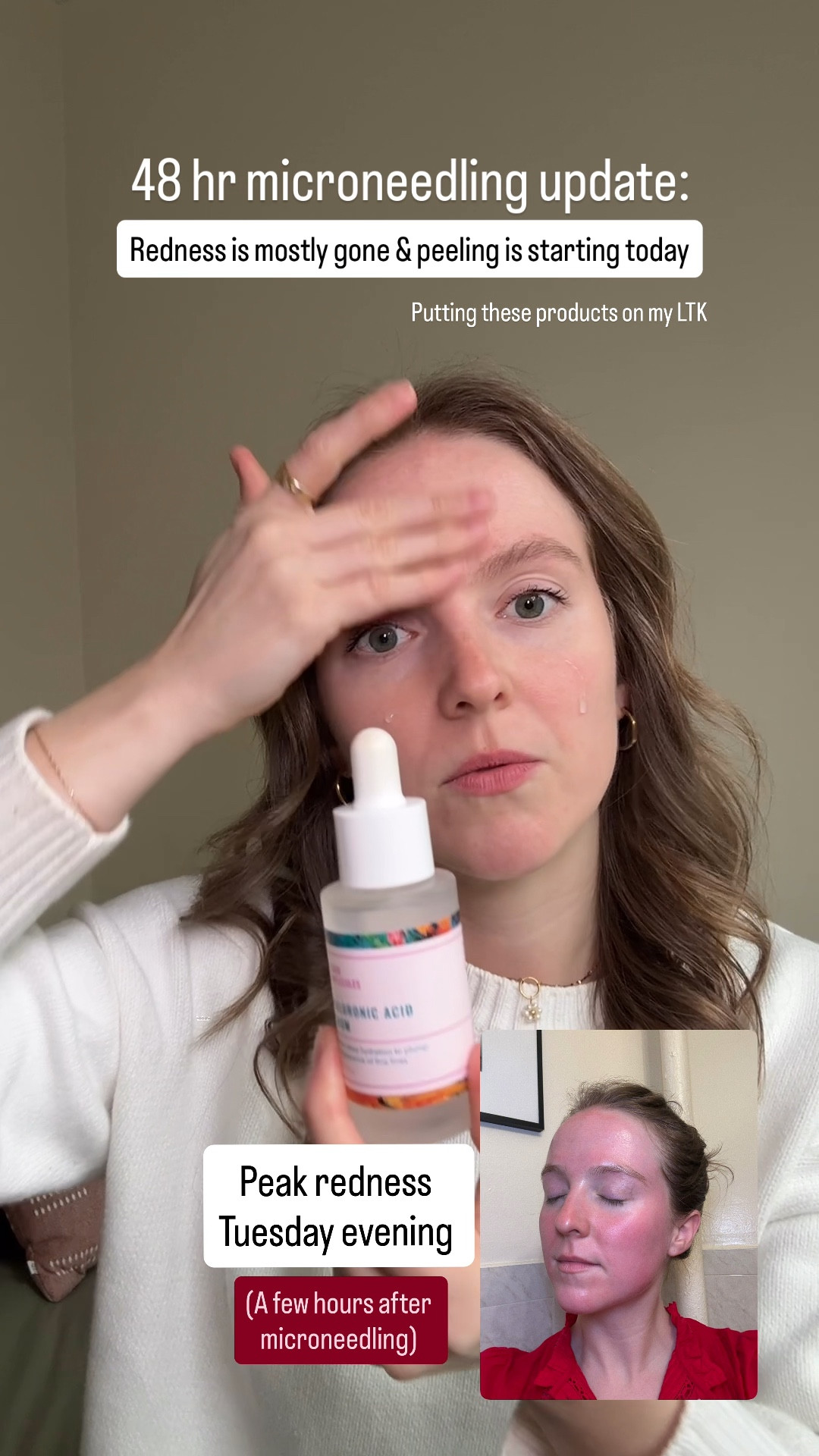 Post microneedling products to help with redness and flakiness. Both budget friendly 

#LTKBeauty