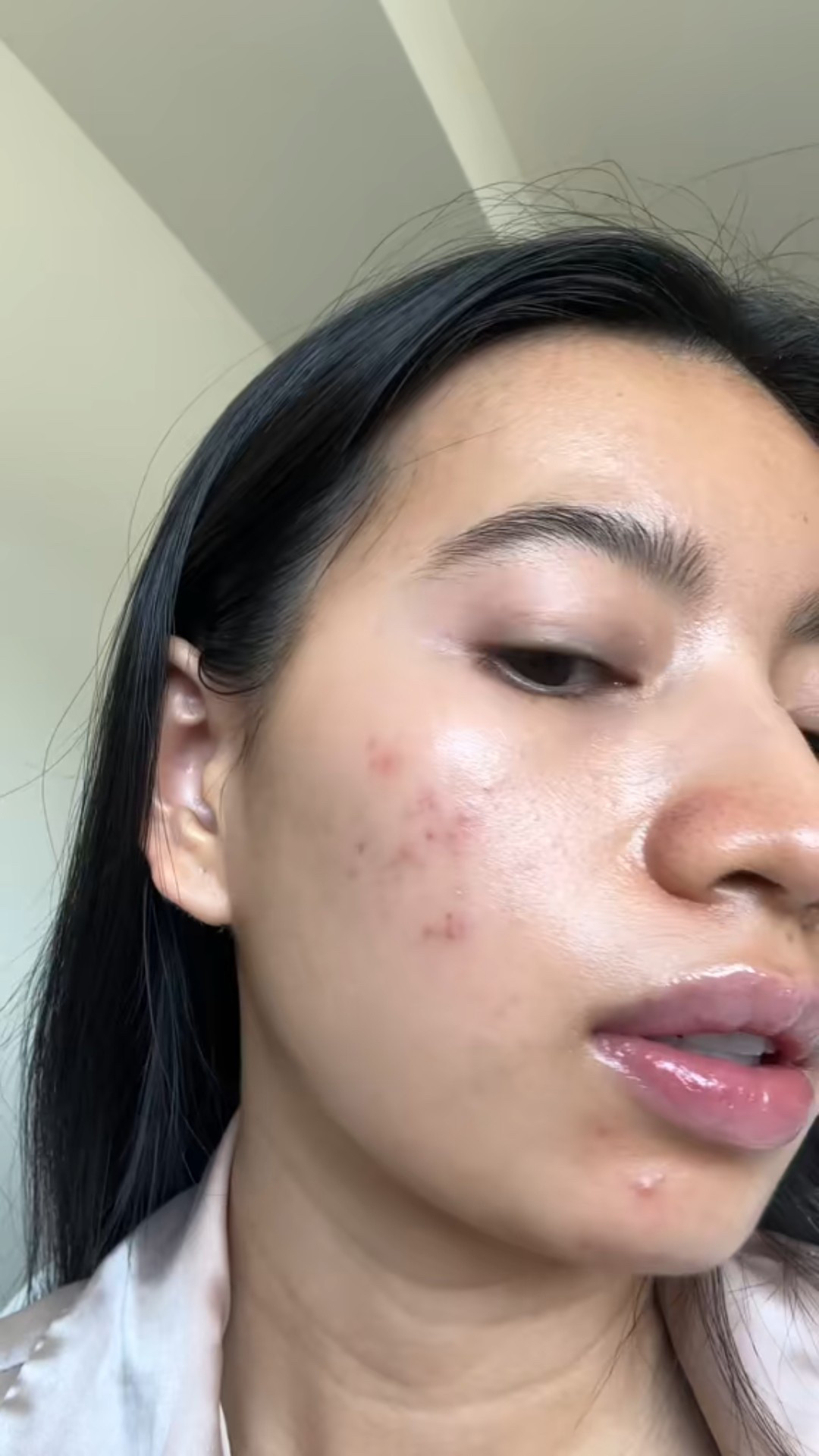 Niacinamide + Zinc = acne saver! 



#LTKselfcare #LTKBeauty