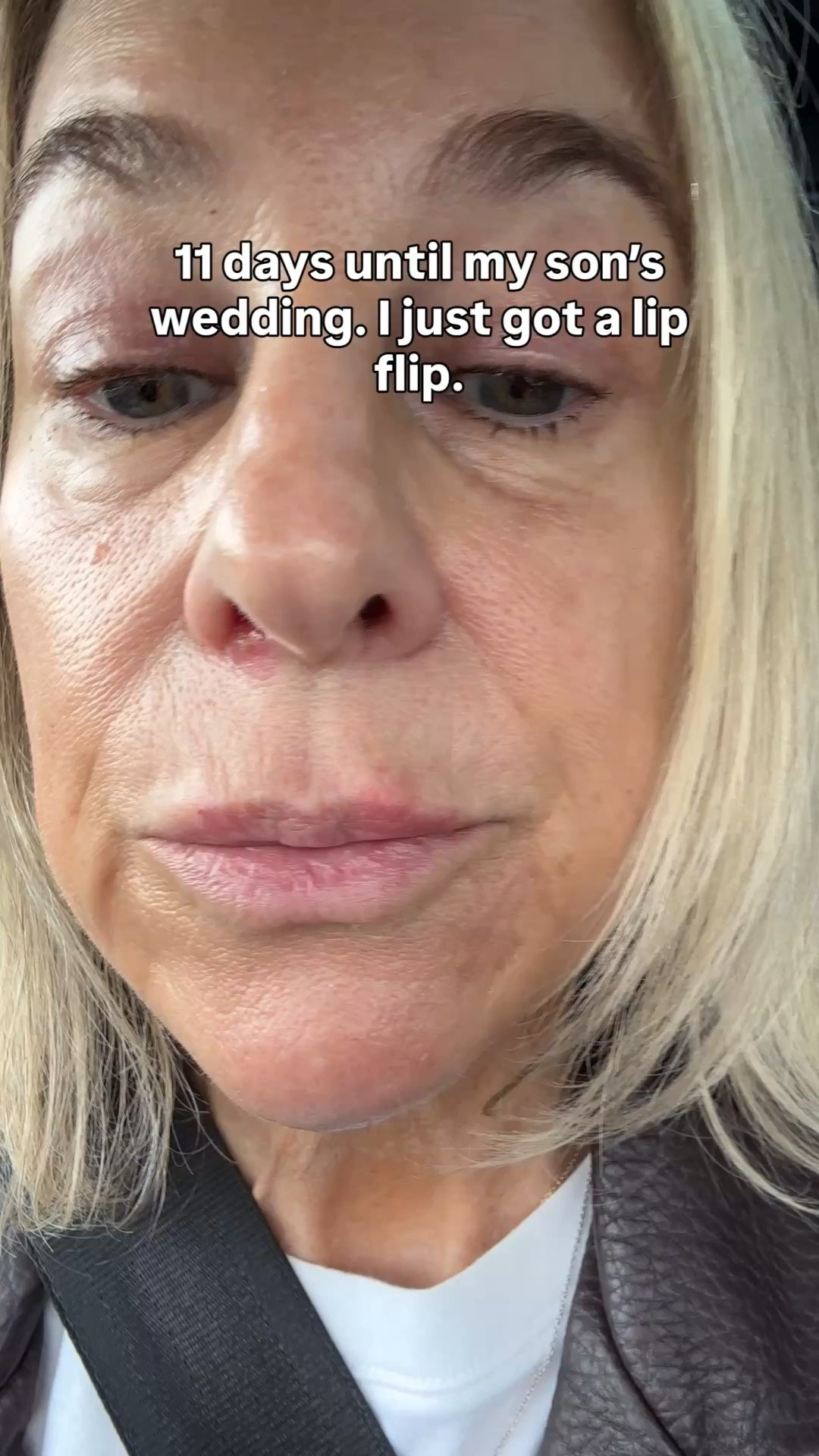 I got a lip flip 11 days before my son’s wedding. Looking for your favorite lip looks!

#LTKOver40 #LTKBeauty #LTKWedding