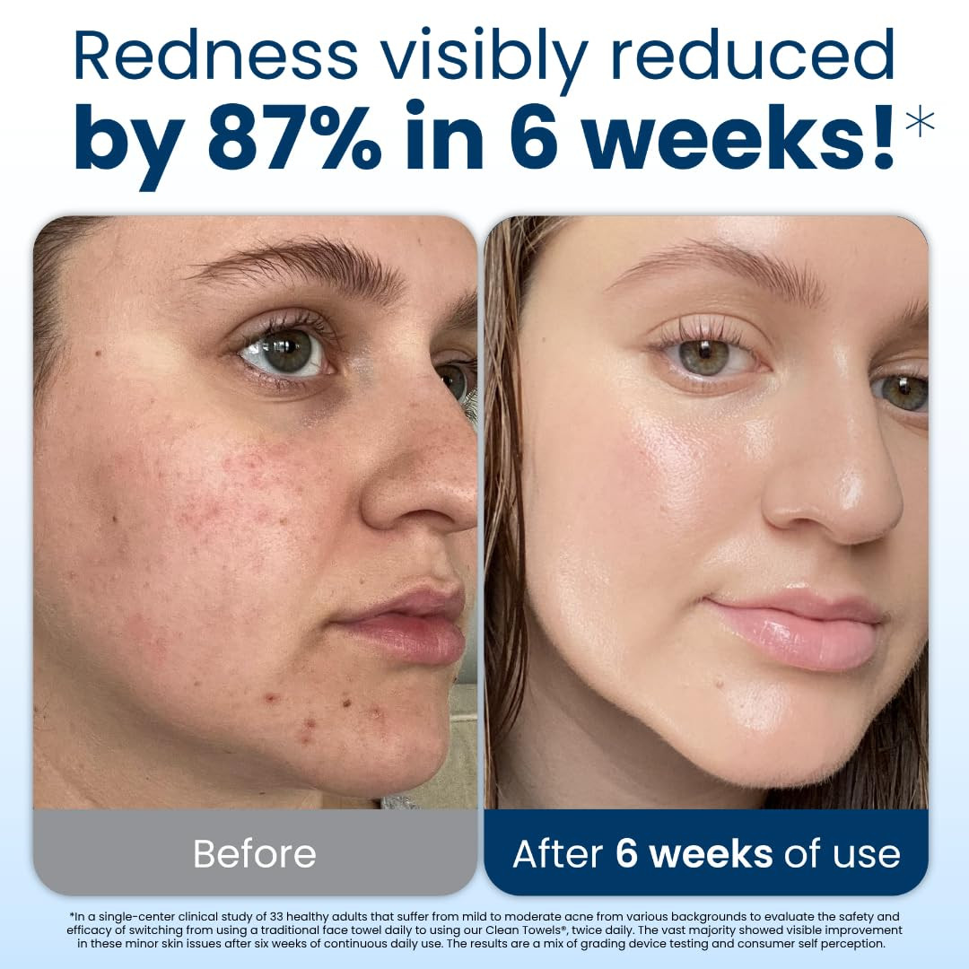 Clean Skin Club Clean Towels XL®, 100% USDA Biobased Face Towel, Disposable Face Towelette, Ecze... | Amazon (US)