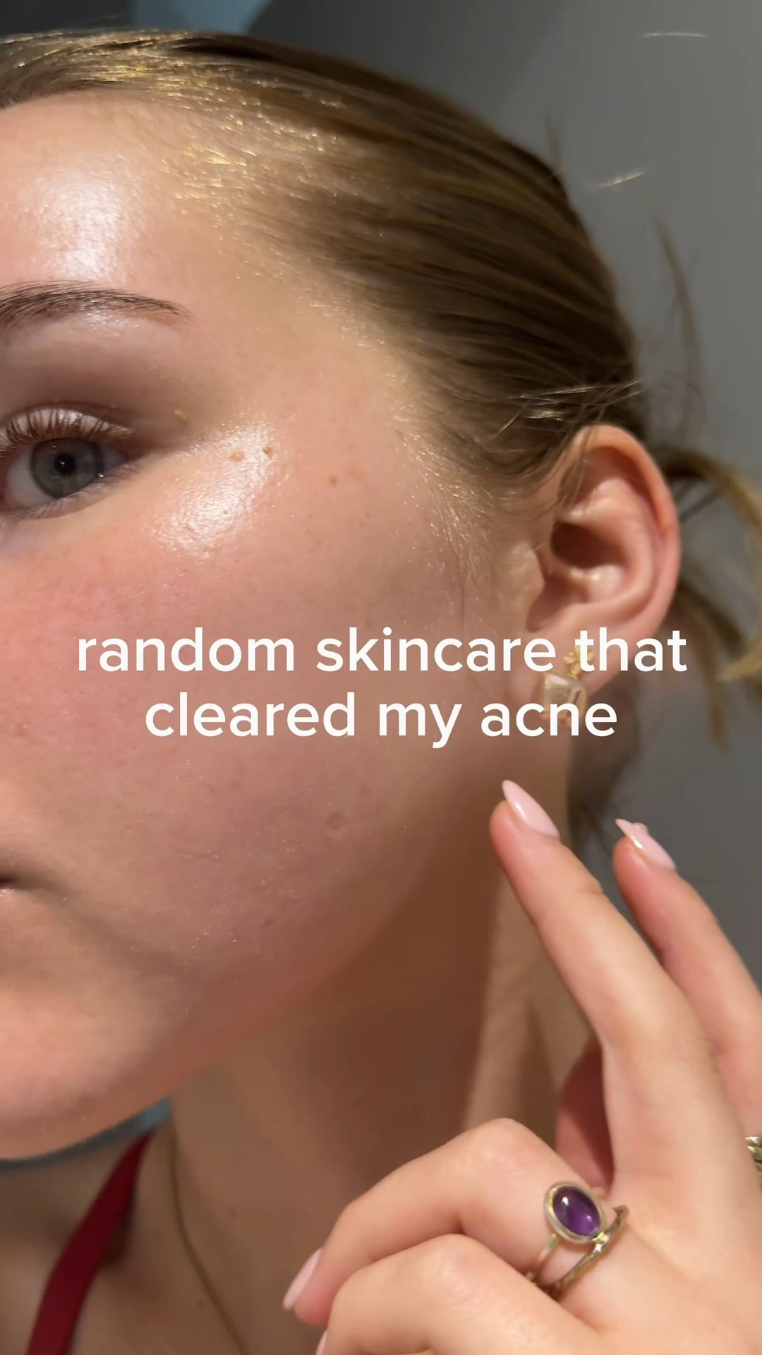 the best skincare for my acne!! Code LIFEWITHMILS2 for discount💕