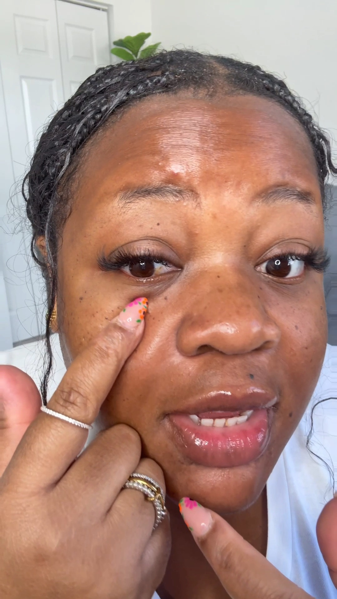 Dark circles under eyes need help!!!