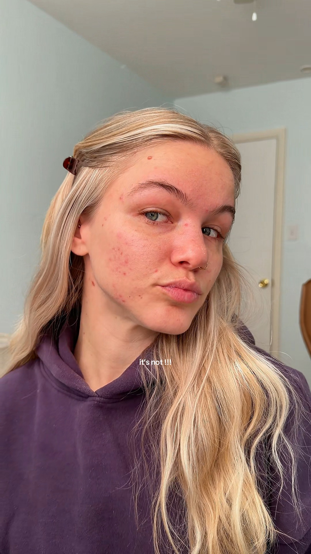 the truth is my skin isn’t clearing up and it’s fall from perfect… but here’s my go-to everyday makeup look that I still feel beautiful in (& you can too if you’re an acne girly) 

#LTKBeauty #LTKselfcare #LTKgrwm