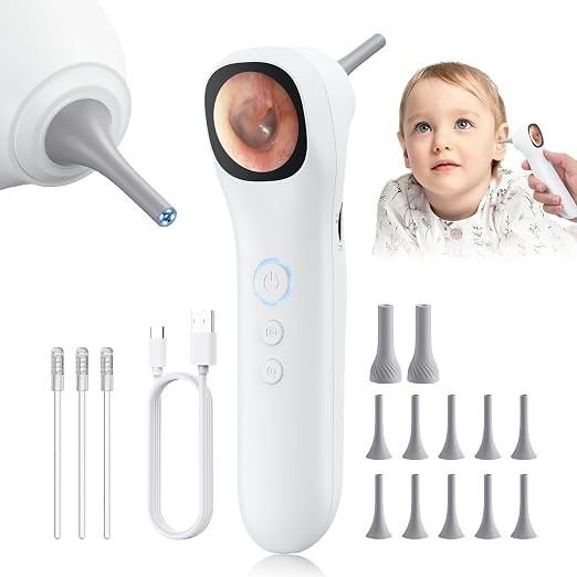 Otoscope Ear Camera with 1.21” Screen, 1080P Ear Scope with 4 LED Lights, Otoscope Camera for A... | Amazon (US)