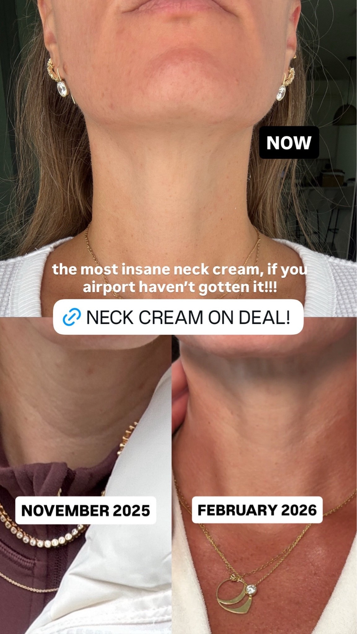 The best neck cream from Amazon! 

Prime Day Beauty, Prime Day Beauty Deals, Amazon Prime Day Beauty, Prime Day Makeup Deals, Prime Day Skincare Deals, Prime Day Hair Care Deals

#LTKSaleAlert #LTKBeauty