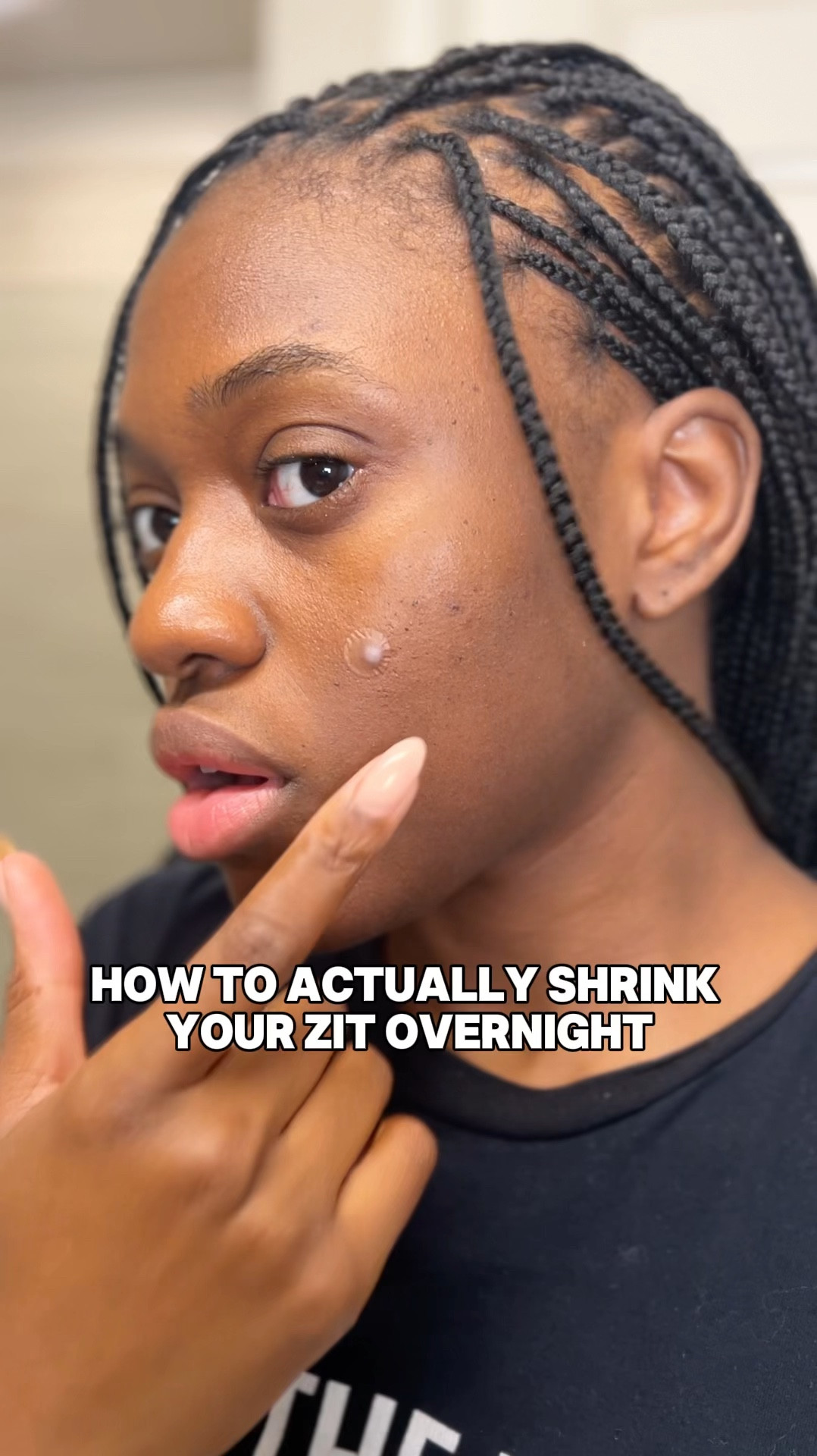 How to Get Rid of Your Pimples using the InkeyList Hydrocolloid Pimple Patch

#LTKBeauty #LTKVideo