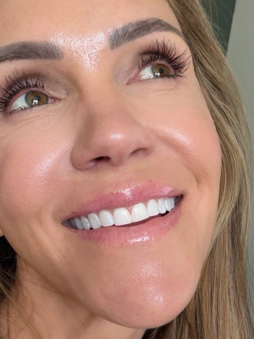 10/10 recommend this hydrating lip gloss with hyaluronic acid!

#LTKBeauty #LTKOver40 #LTKmomlife