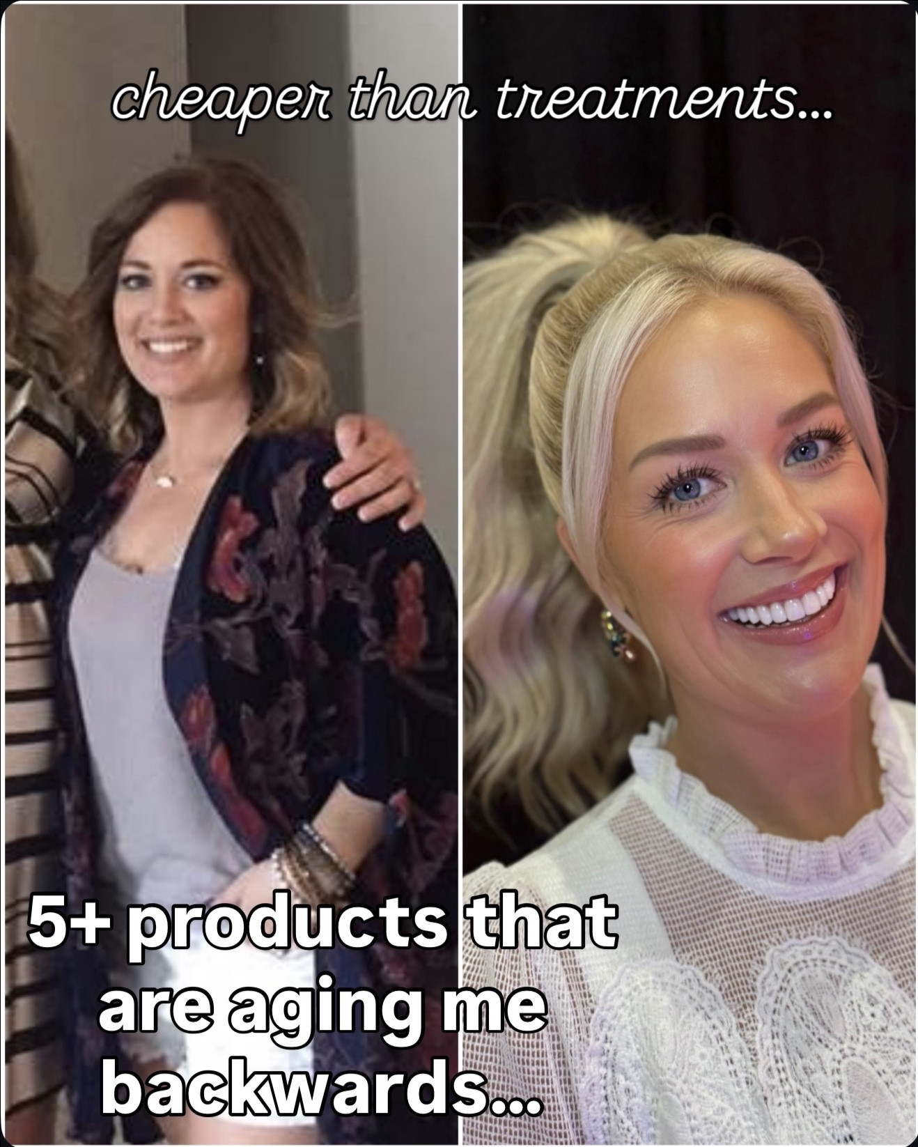 5 skincare products and this one device that will totally change your skin !!! All on Amazon and so much cheaper than treatments 
