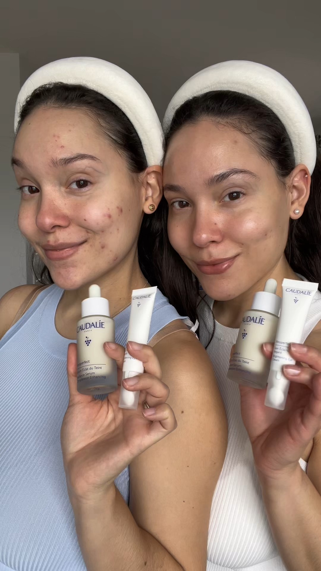 Caudalie just made our skin look better 🍇✨💙

#LTKstyletip #LTKcanada #LTKbeauty