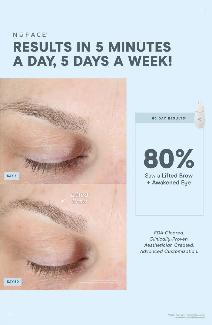 TRINITY+ Smart Advanced Facial Toning Device & Effective Lip & Eye Attachment $619 Value | Nordstrom