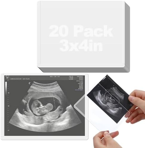 Easy-Slide Photocard Sleeves Photo Protector for 3x4in Ultrasound Pictures | Amazon (US)